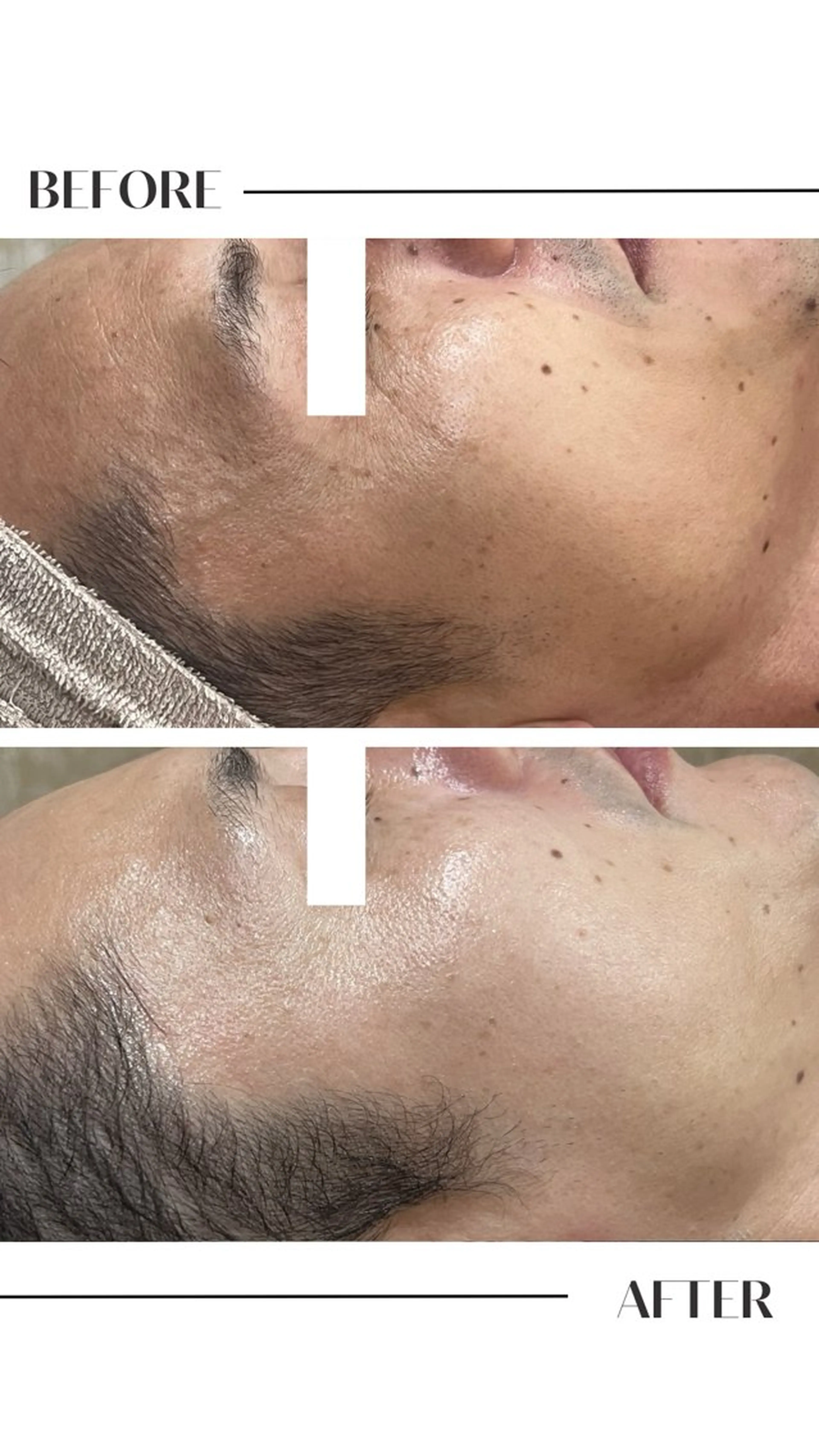 エステ フェイシャル/脱毛 ジョアアンジェ竹田のエステ・リラクイメージ