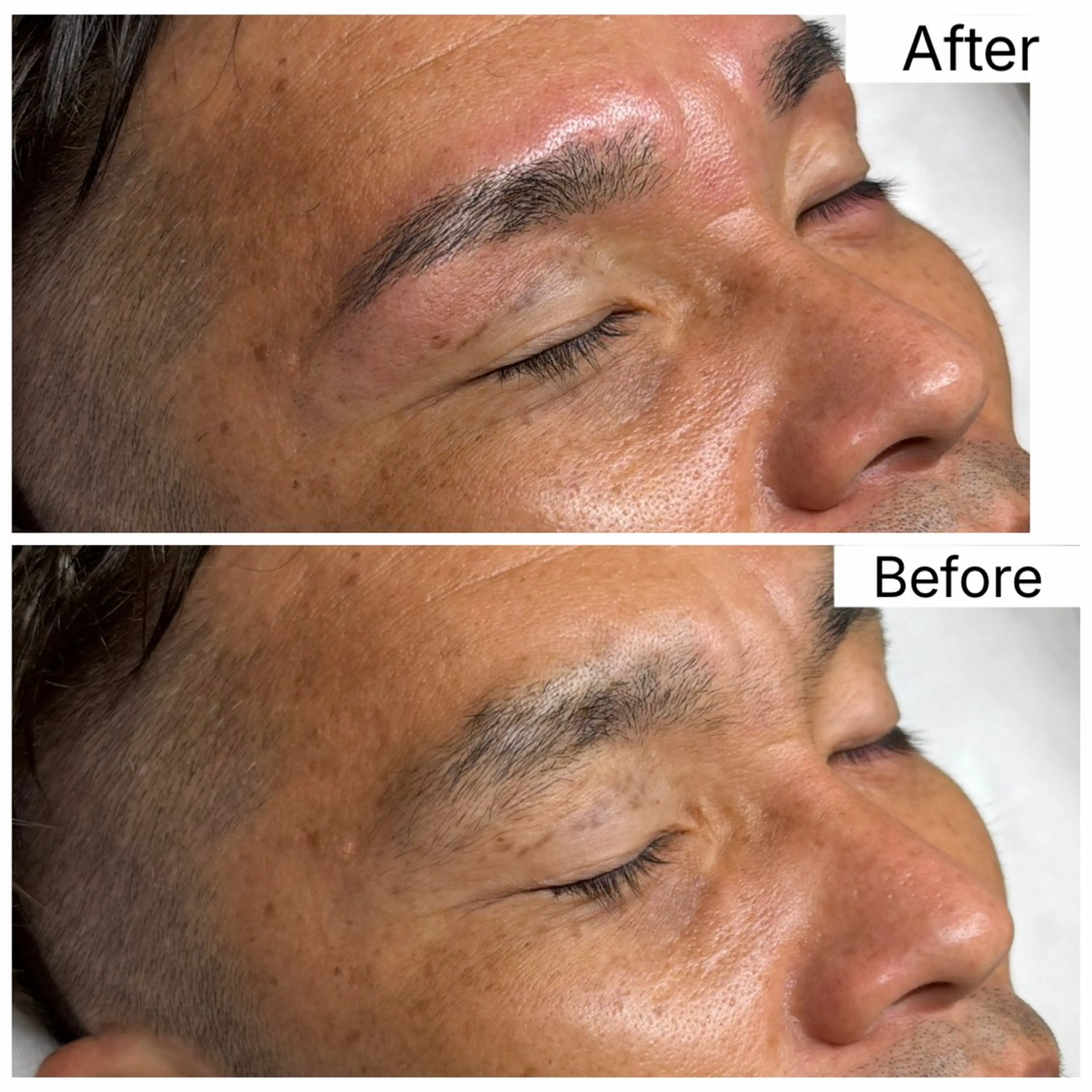 メンズ ワックス脱毛 その他(アイブロウ) トロイアルケ🩵 美眉EMIの眉毛・アイブロウイメージ