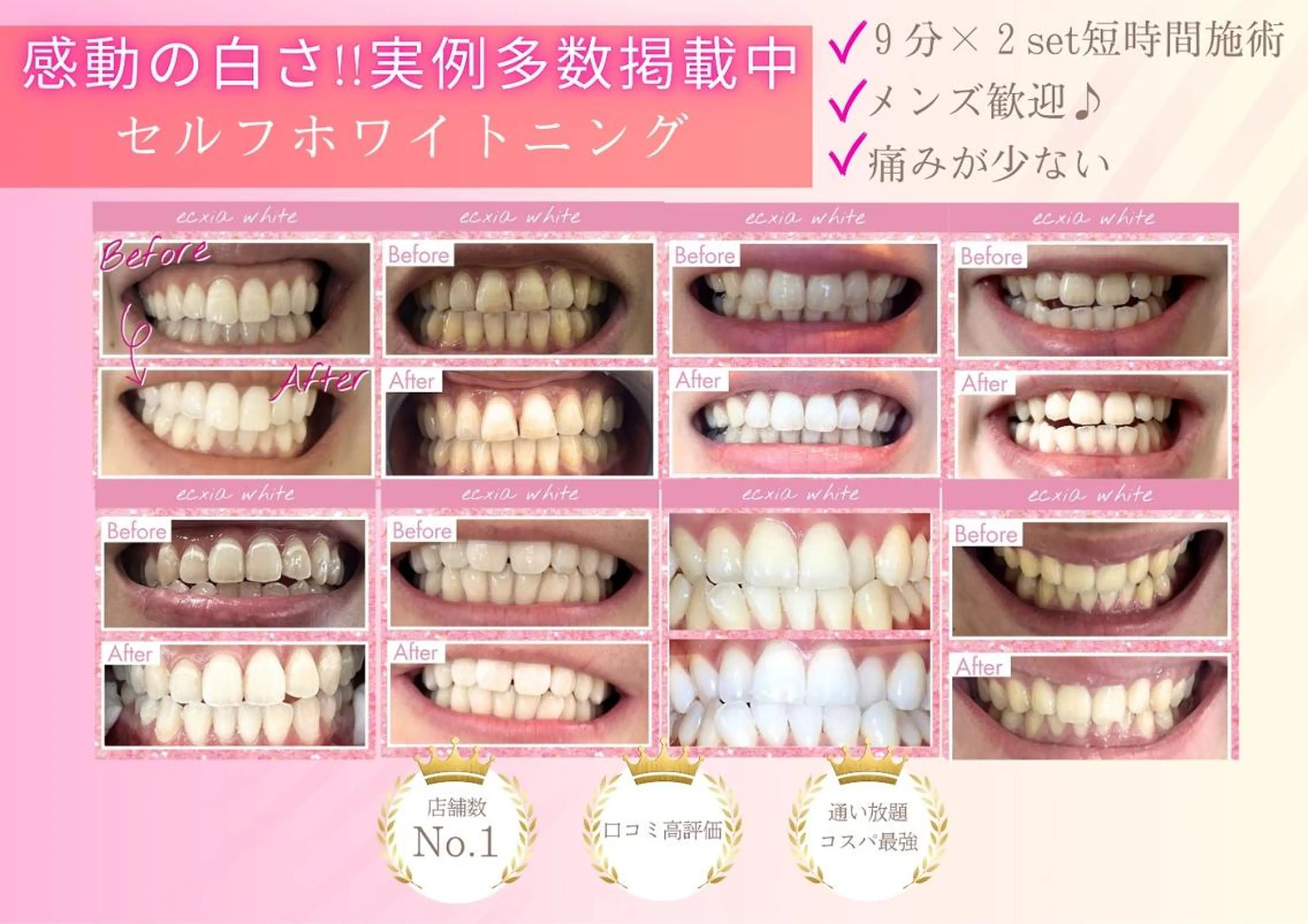 セルフホワイトニング エクシア五反田店のその他イメージ