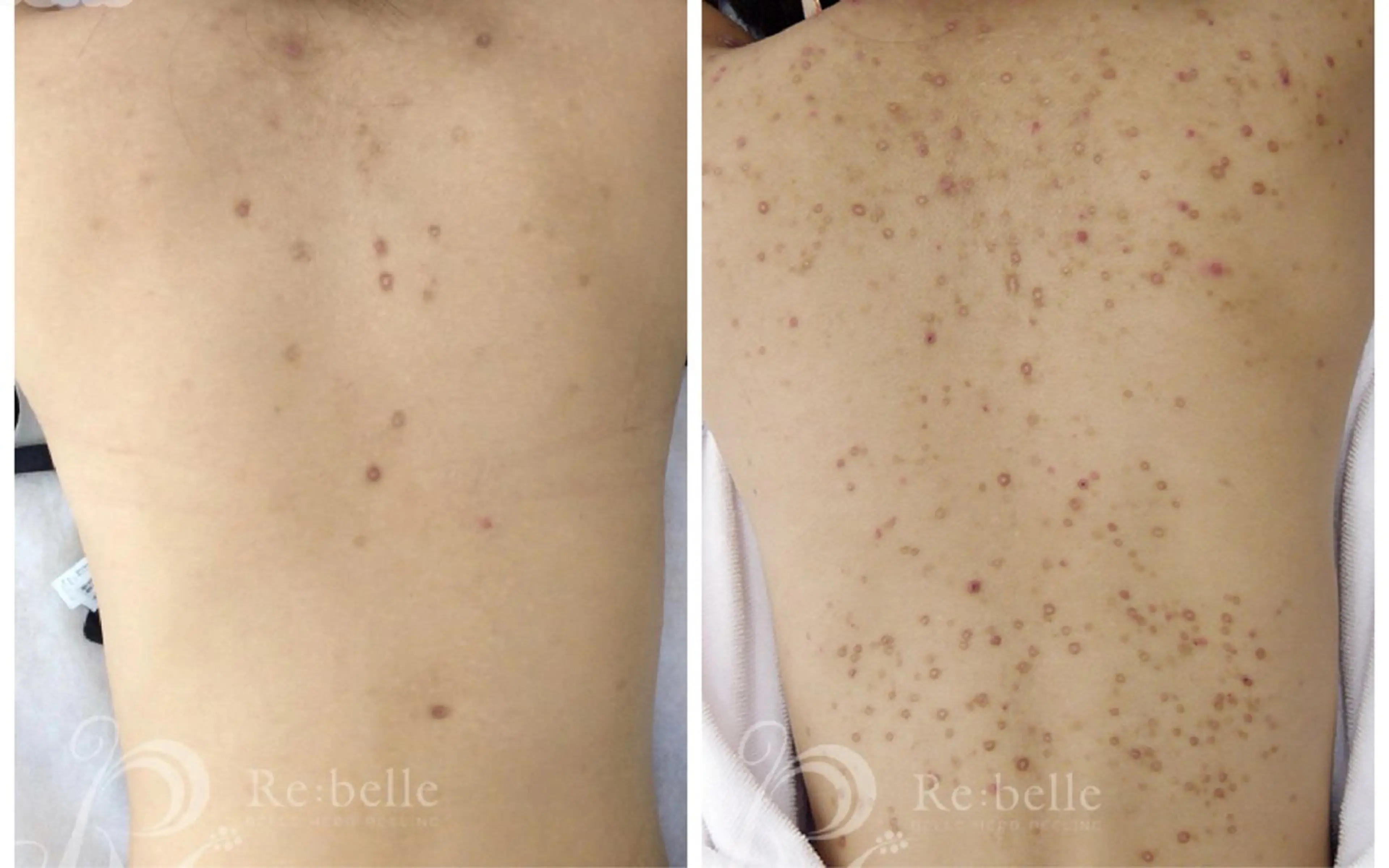 メンズ 【脱毛・美肌専門】メンズ&レディースサロンBell style所属・【脱毛・美肌専門】 bellstyleのエステ・リラクイメージ