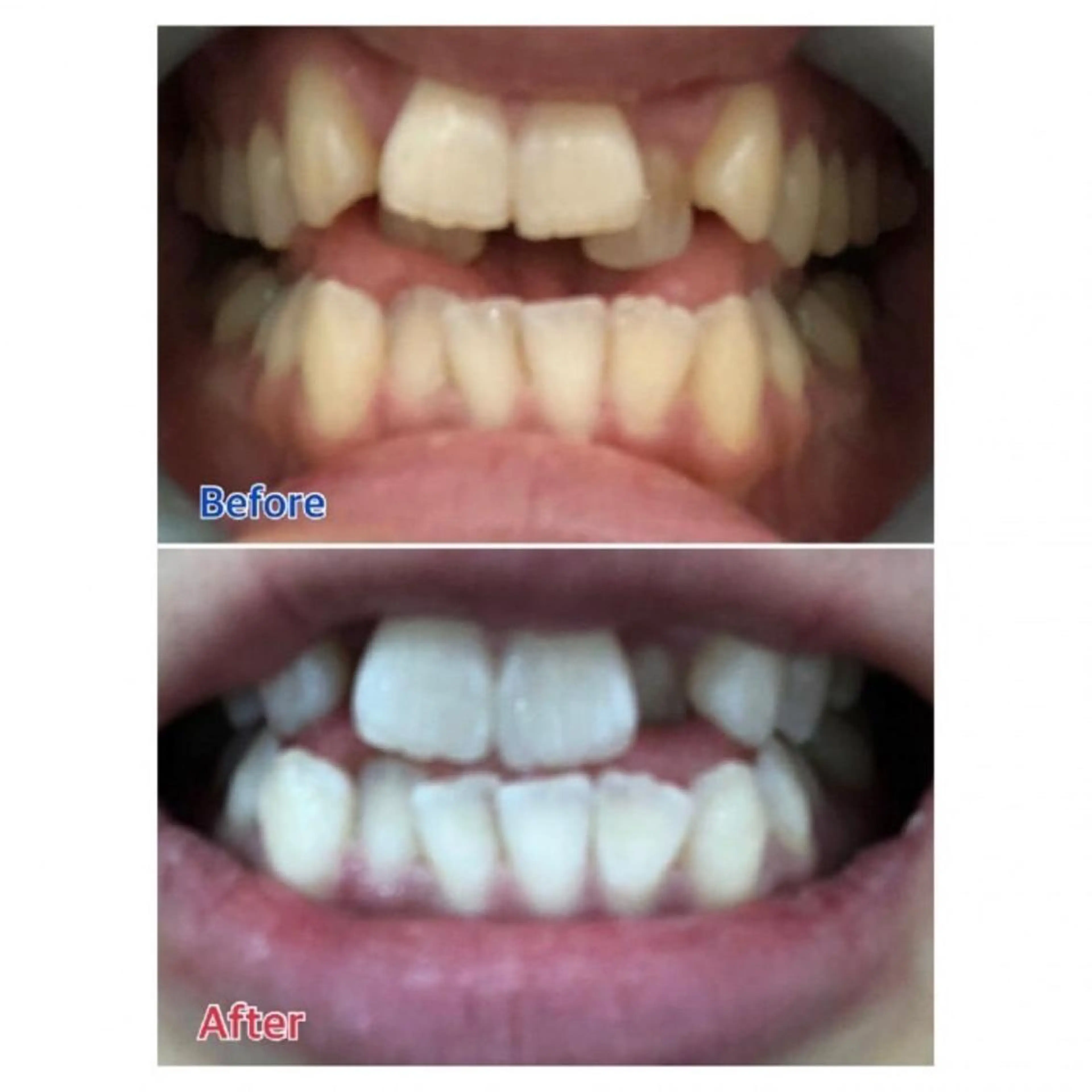 M渋谷 ホワイトニングのエステ・リラクイメージ