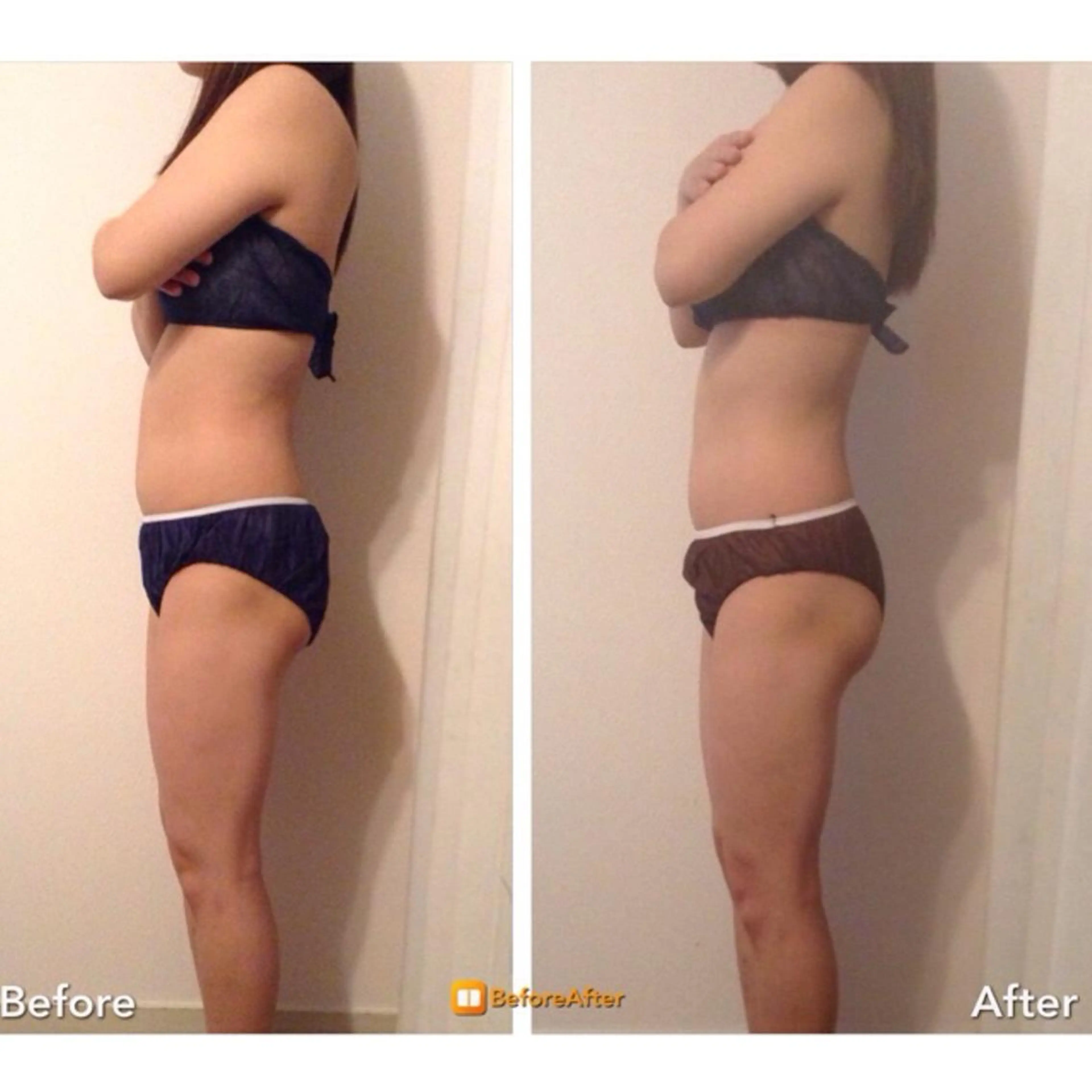 小尻・太もも痩せる エステルナボーテのエステ・リラクイメージ