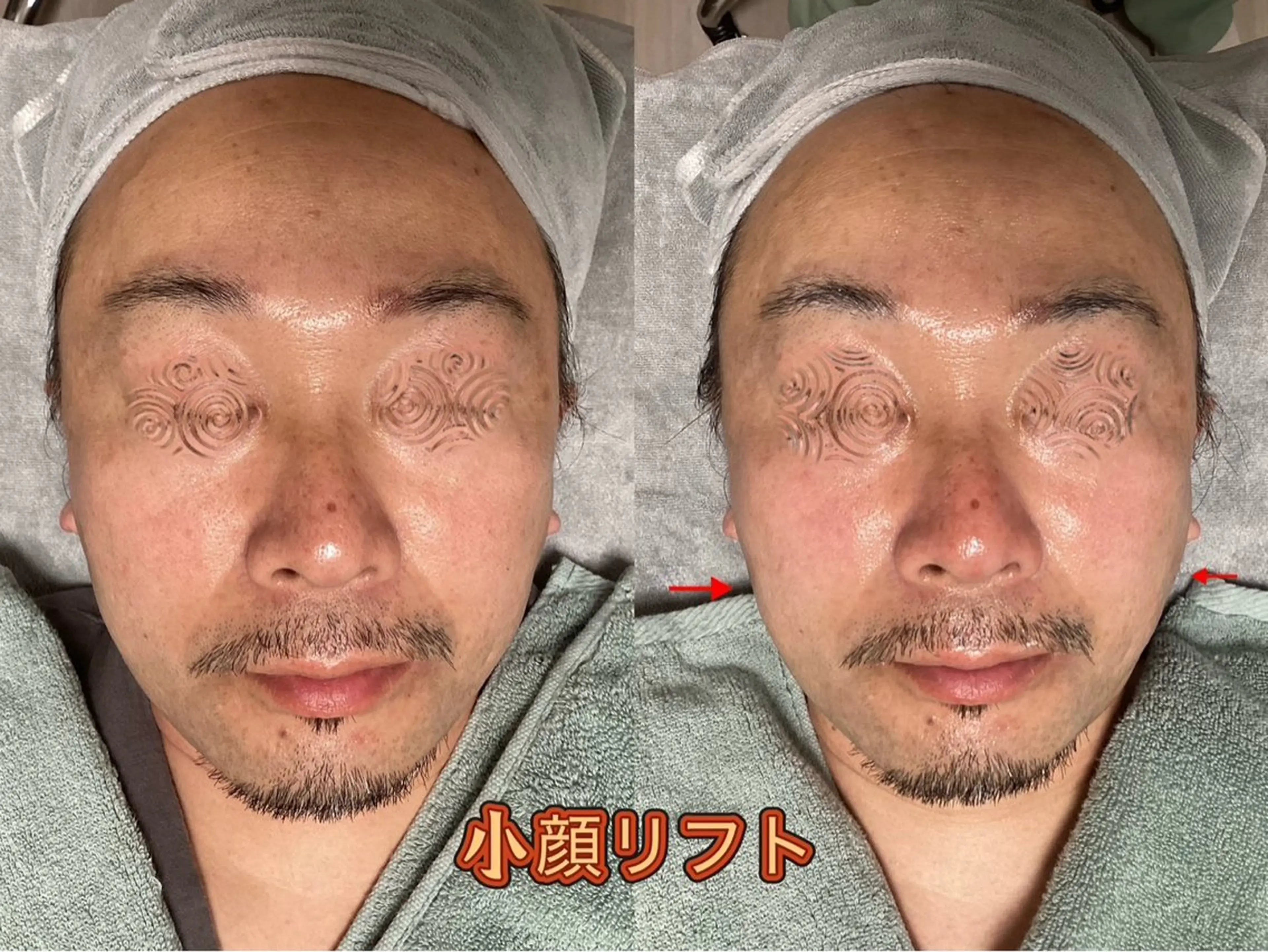 メンズ エステ ホワイティアビシェル ウラワ　白澤奇のエステ・リラクイメージ