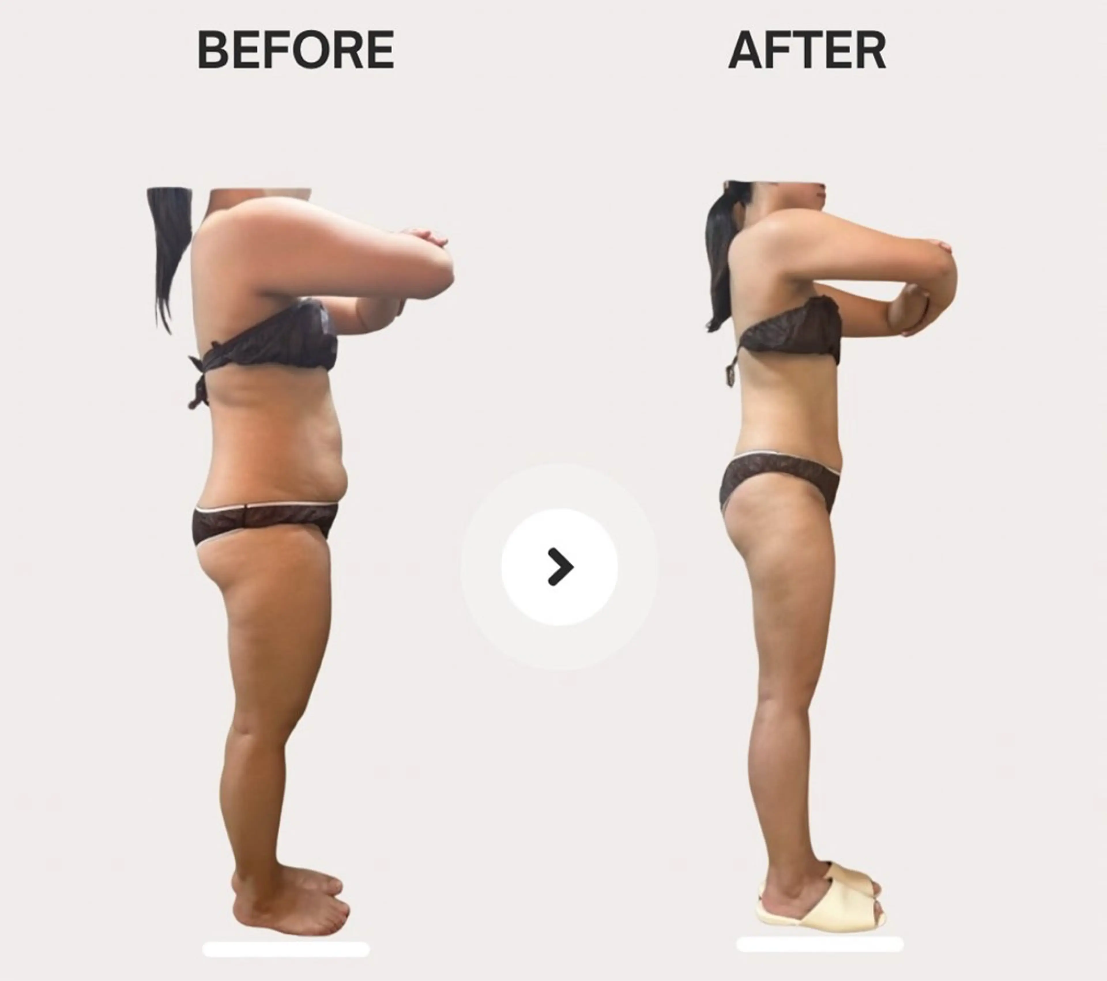 《biloop式筋膜痩身15回コース🌿》5回分オプション特典付✨ (1回あたり11,000円)の写真