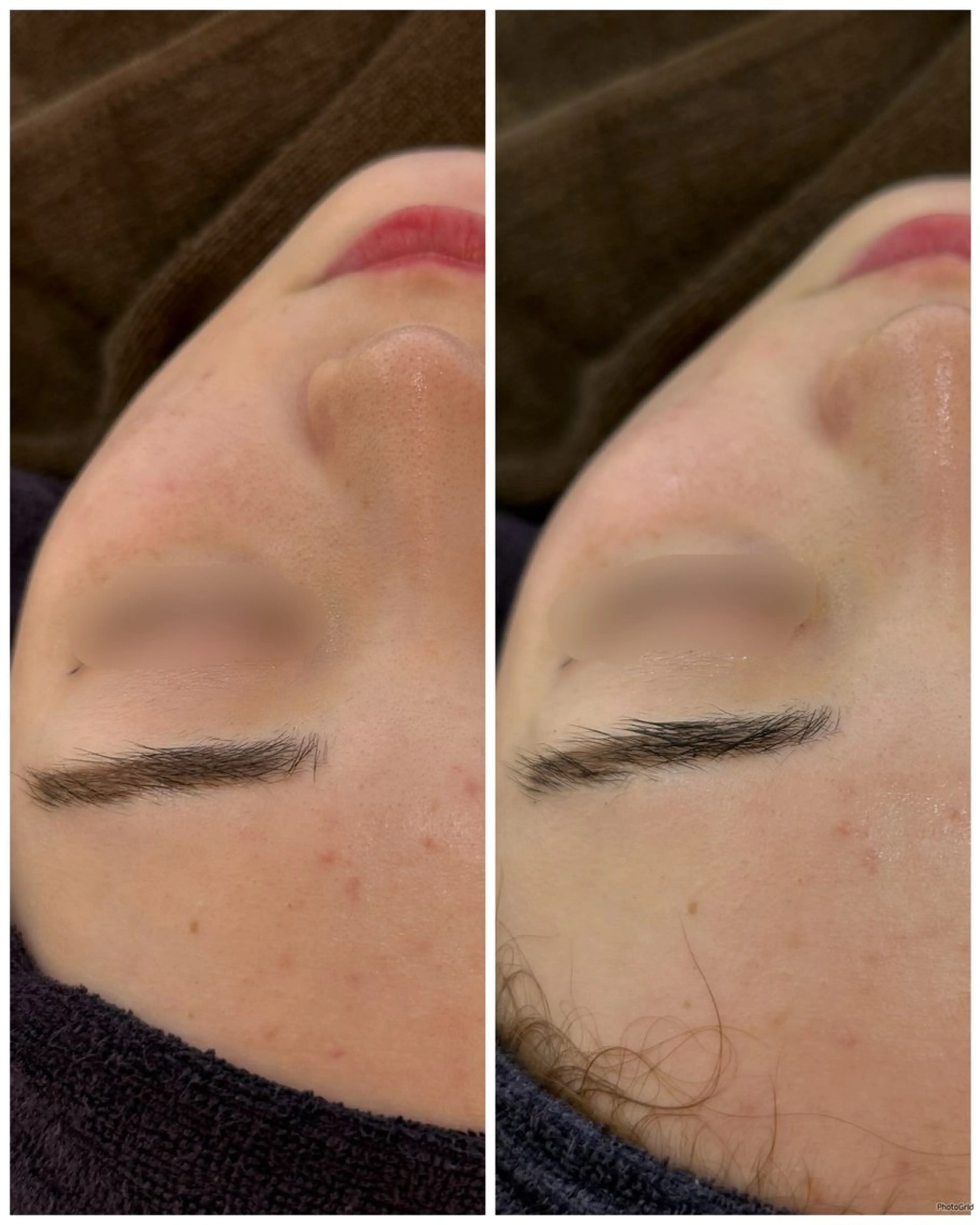 エステ yukiko/美容師 肌質改善/中崎町のエステ・リラクイメージ