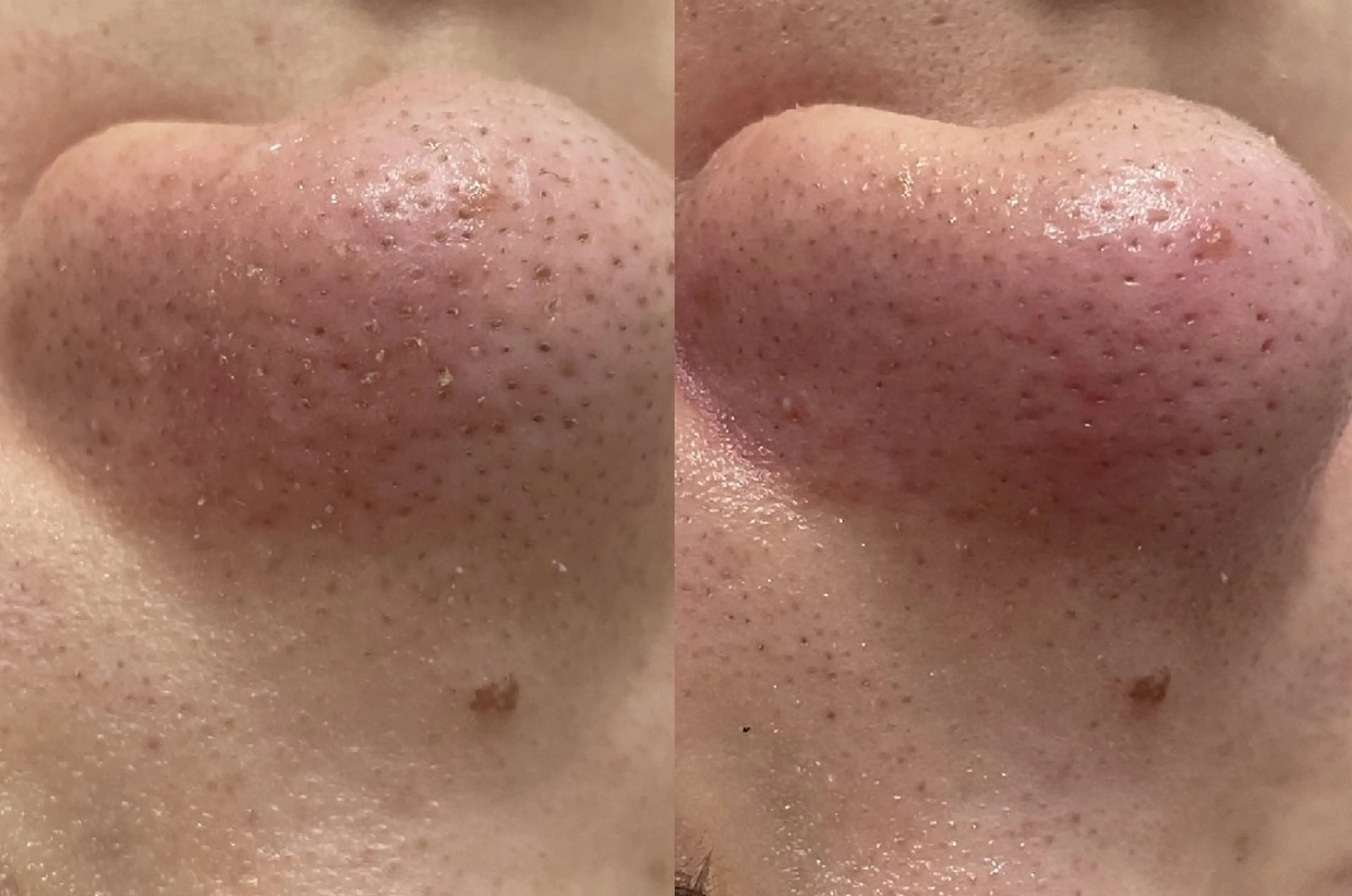 エステ sii MIUのエステ・リラクイメージ