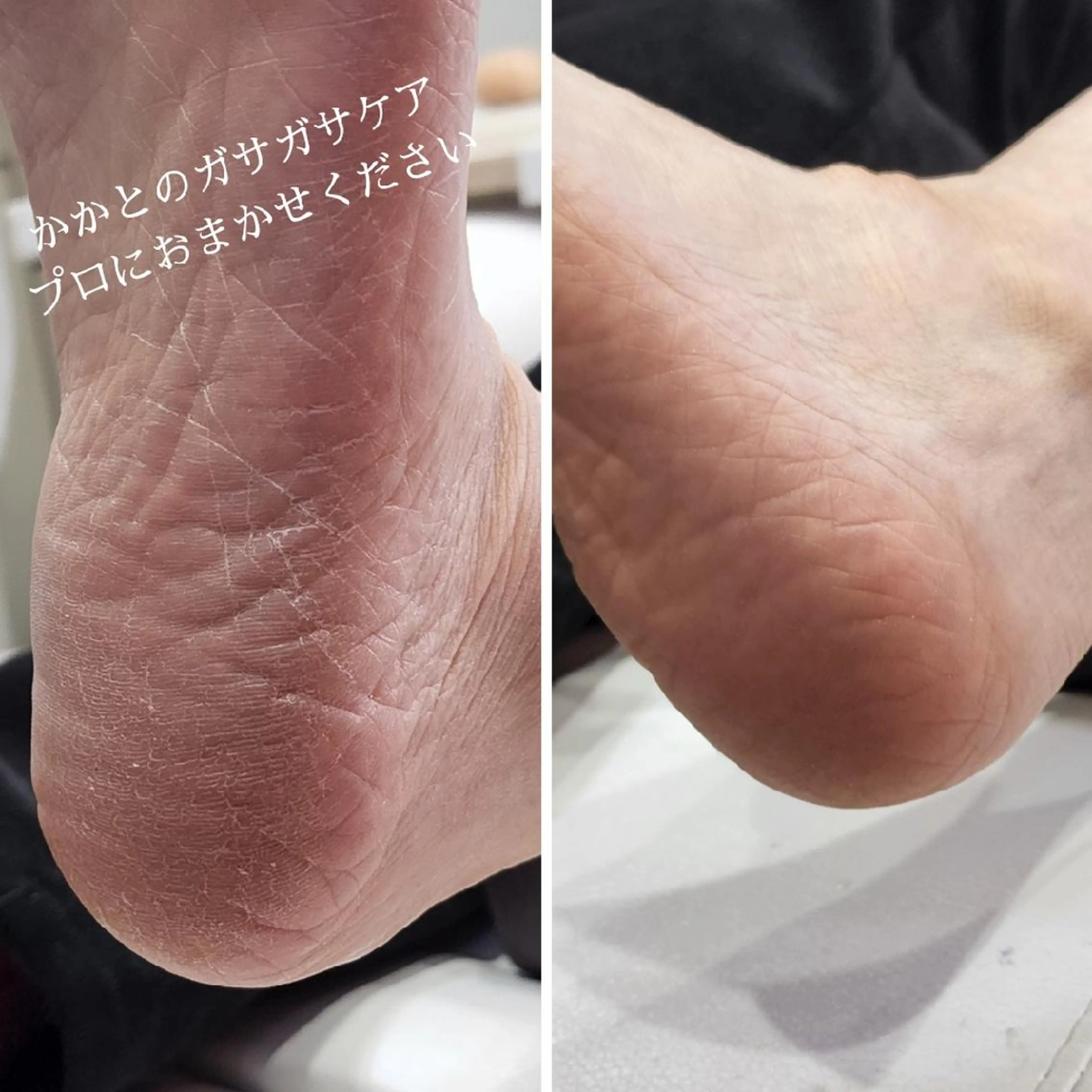 ネイル 【現金払いのみ】 Uru(うる)のネイルデザイン