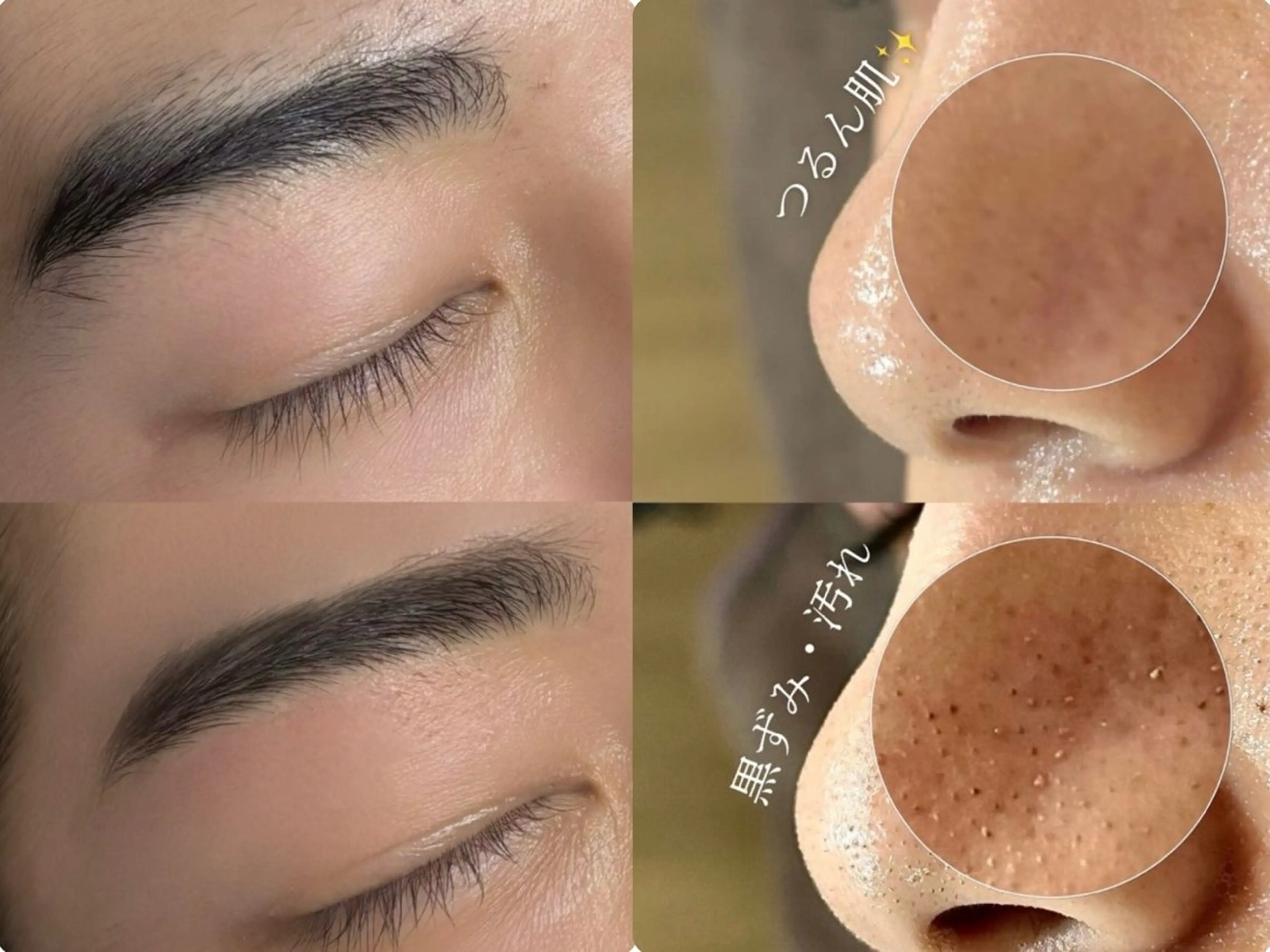 【人気セット🗣️】韓国式毛穴洗浄+似合わせ眉毛wax✍🏻〰️メンズ/レディース 毛穴の黒ずみ&眉毛を同時お手入れ!の写真