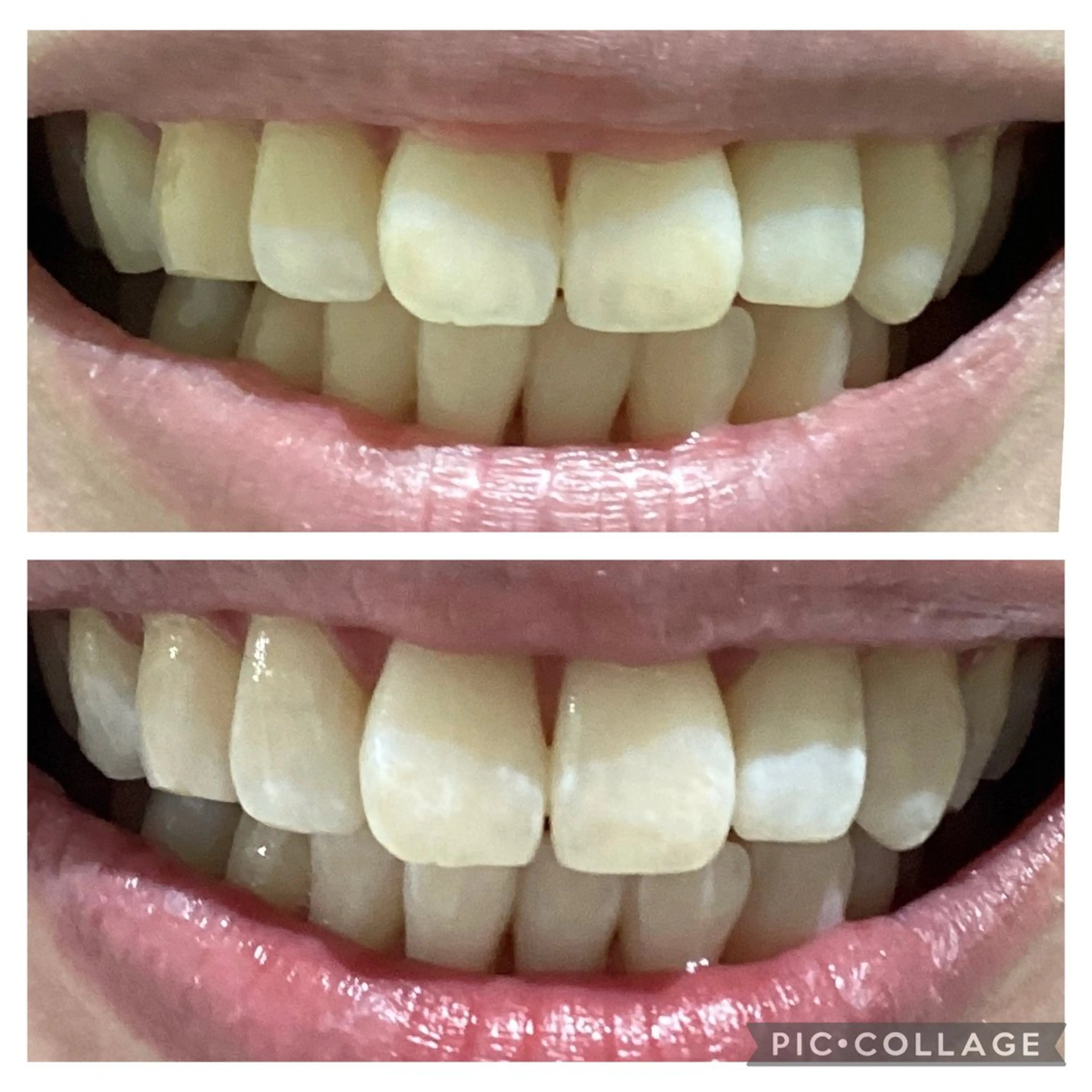 セルフホワイトニングサロン　Betee所属・セルフホワイトニング Beteeのエステ・リラクイメージ