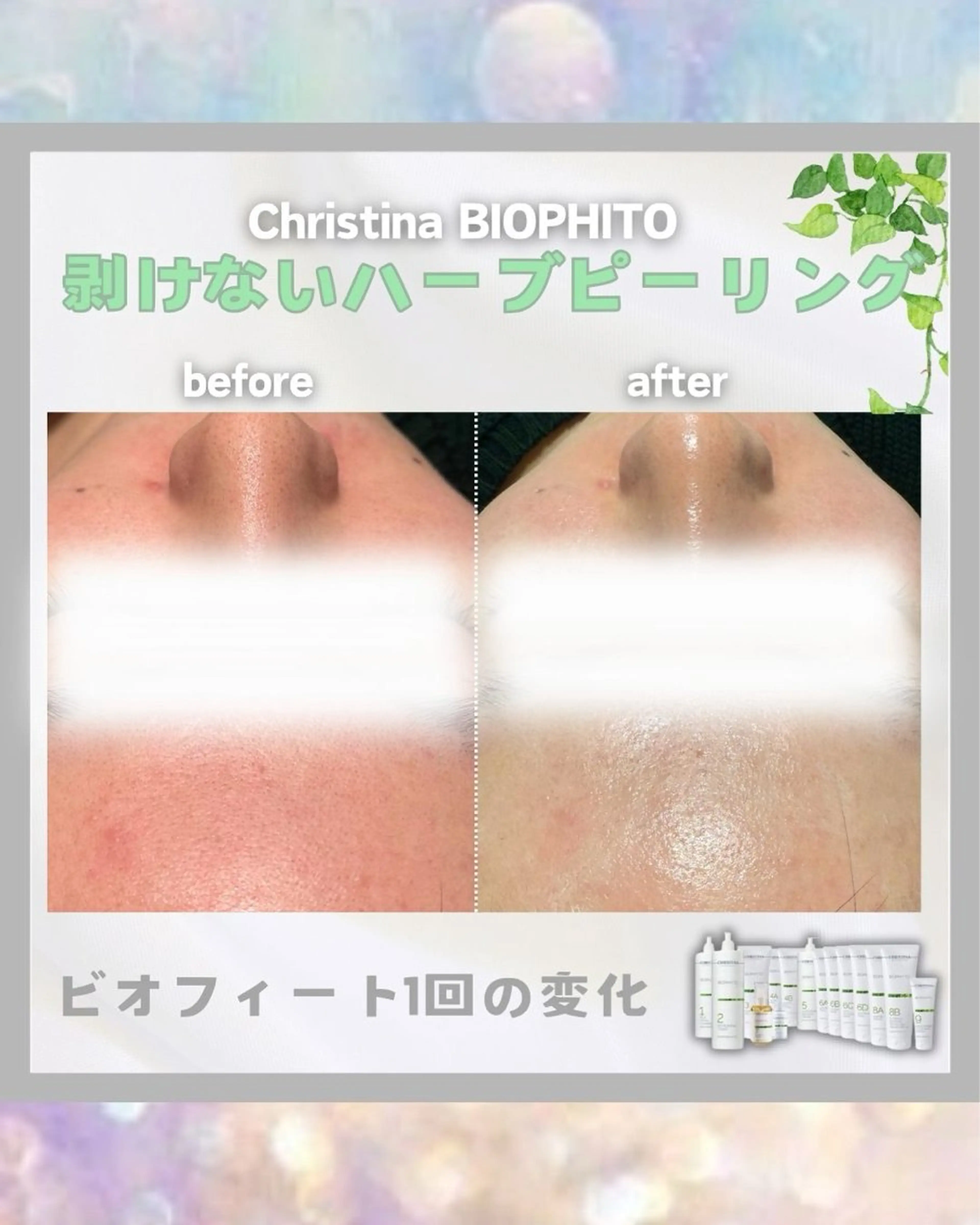 【剥けないハーブピーリング】の写真