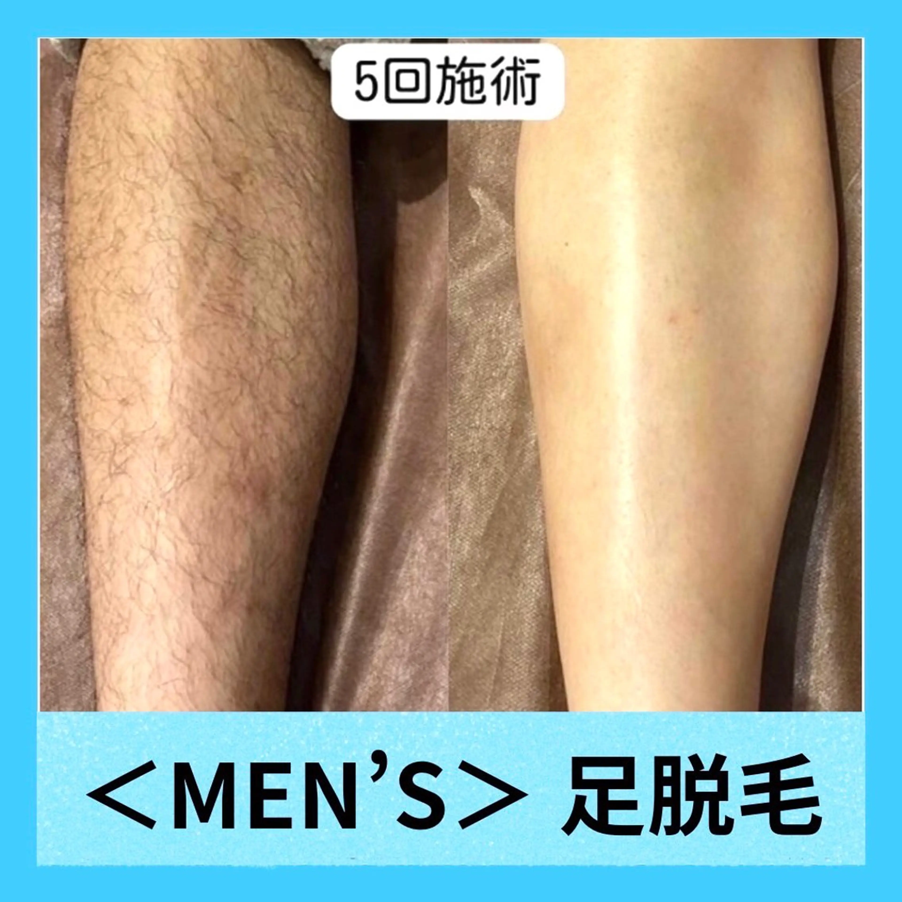 メンズ メディカルエステ マドンナのエステ・リラクイメージ