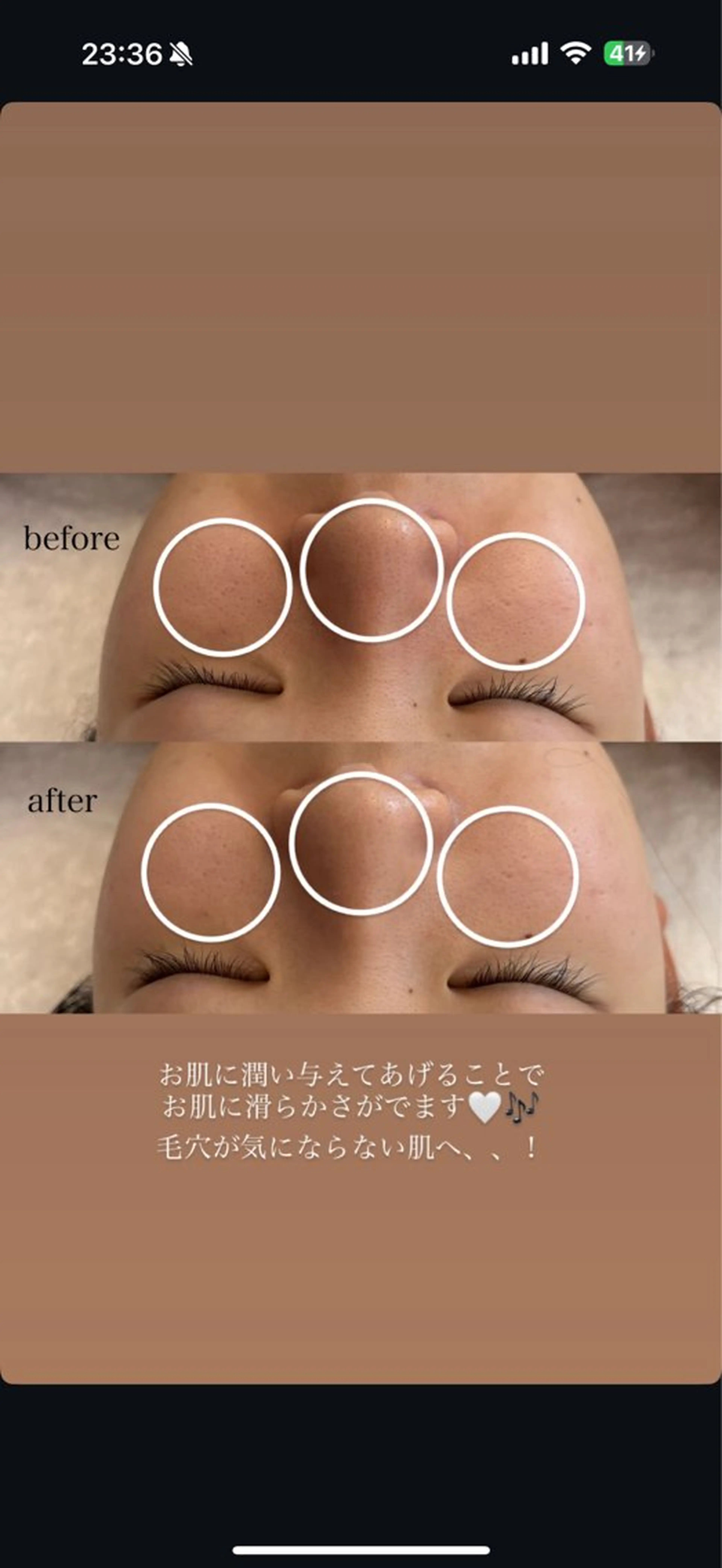 エステ メナード MIYUのその他イメージ