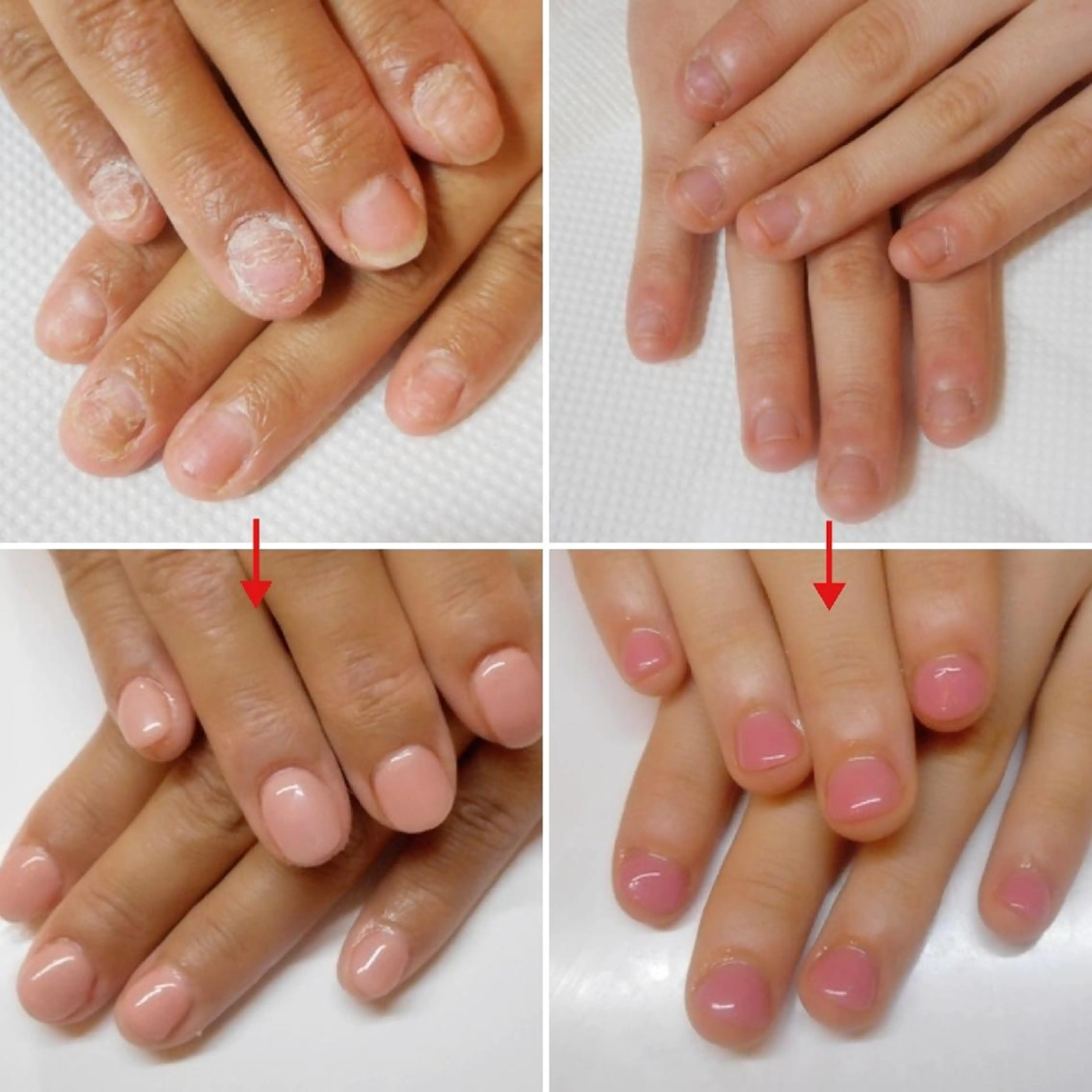 ネイル ネイルサロン アリュームのネイルデザイン