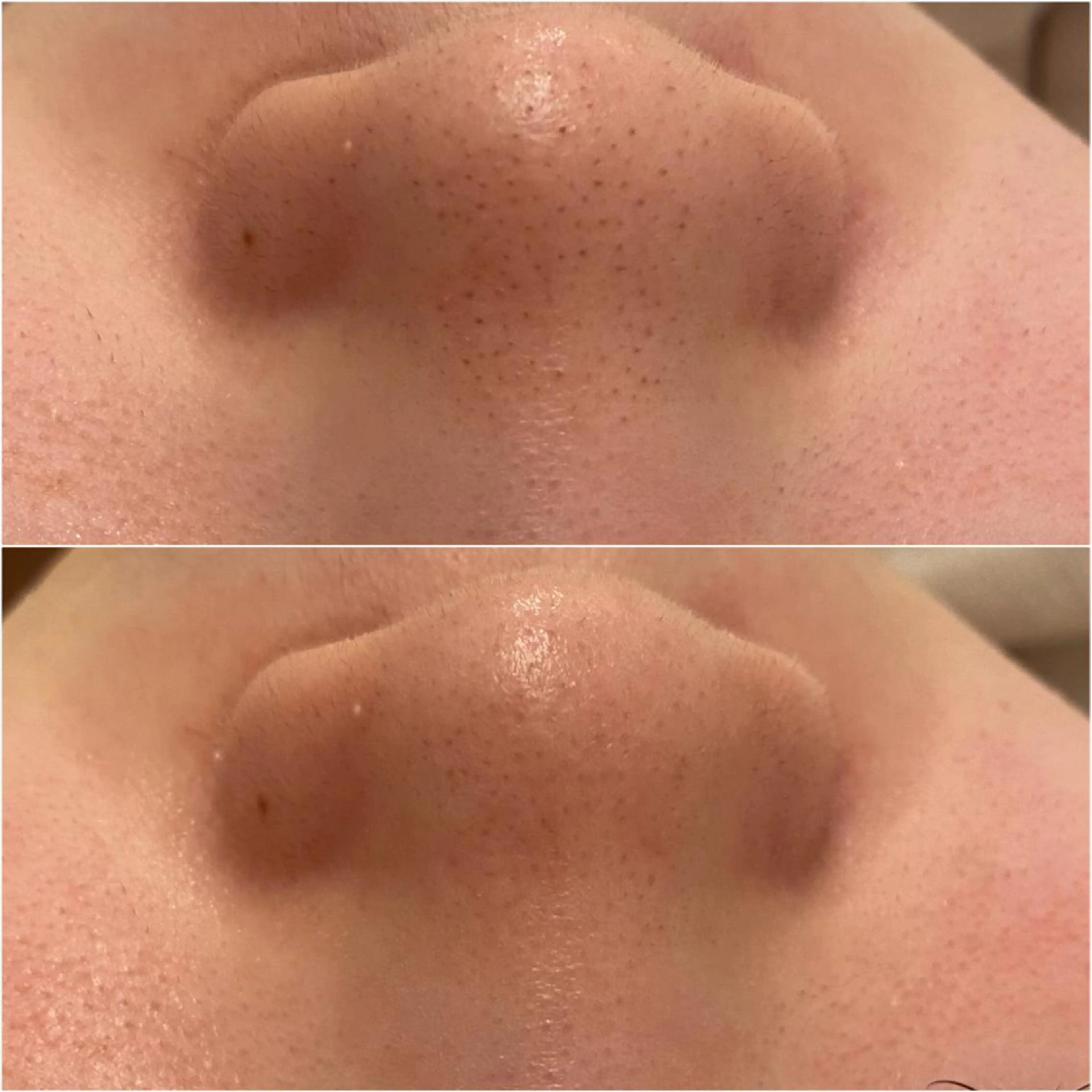 ララ/ハーブ メゾンリュバンのエステ・リラクイメージ