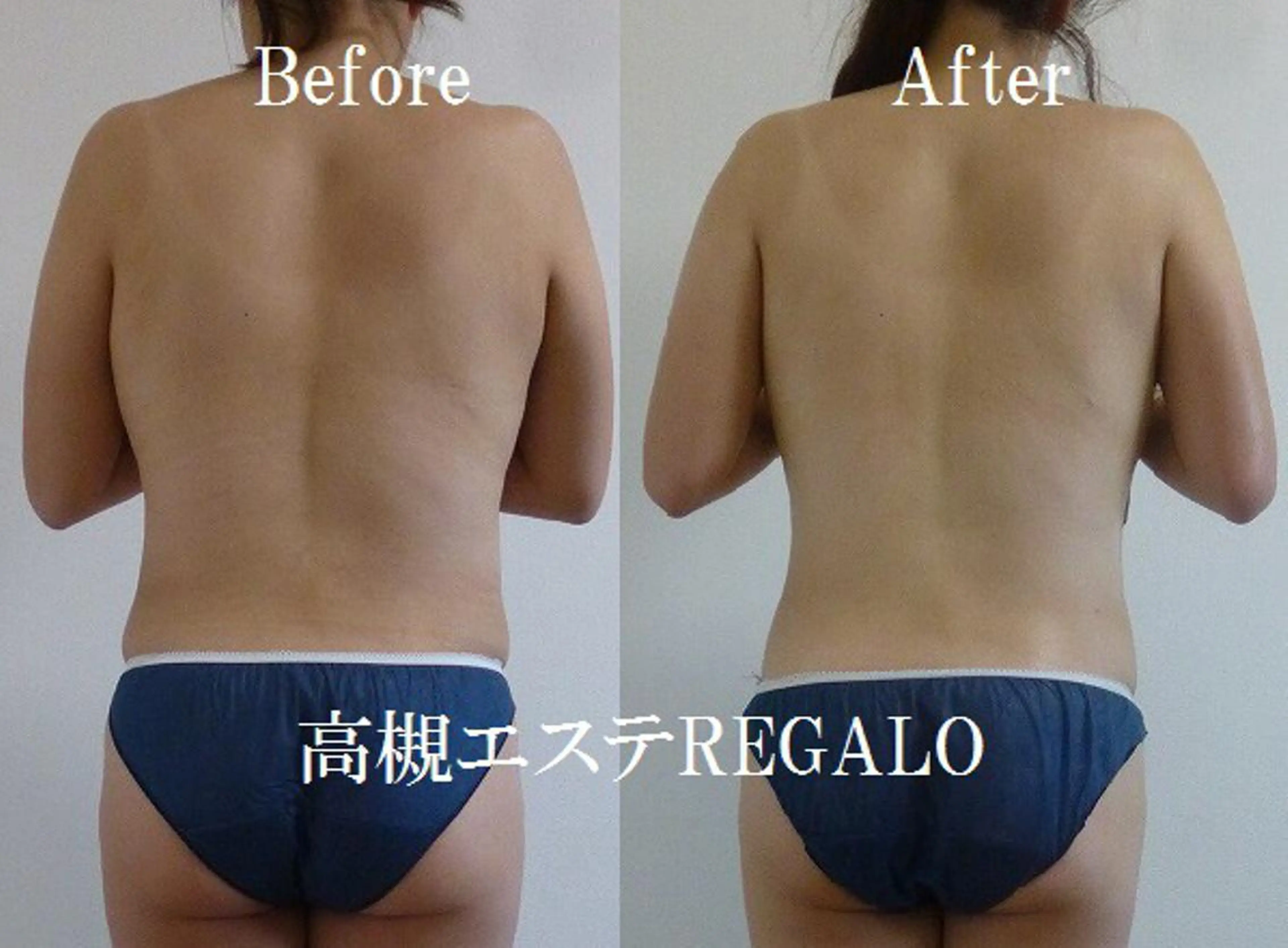 エステ リラク REGALO所属・矢野 さやかのエステ・リラクイメージ