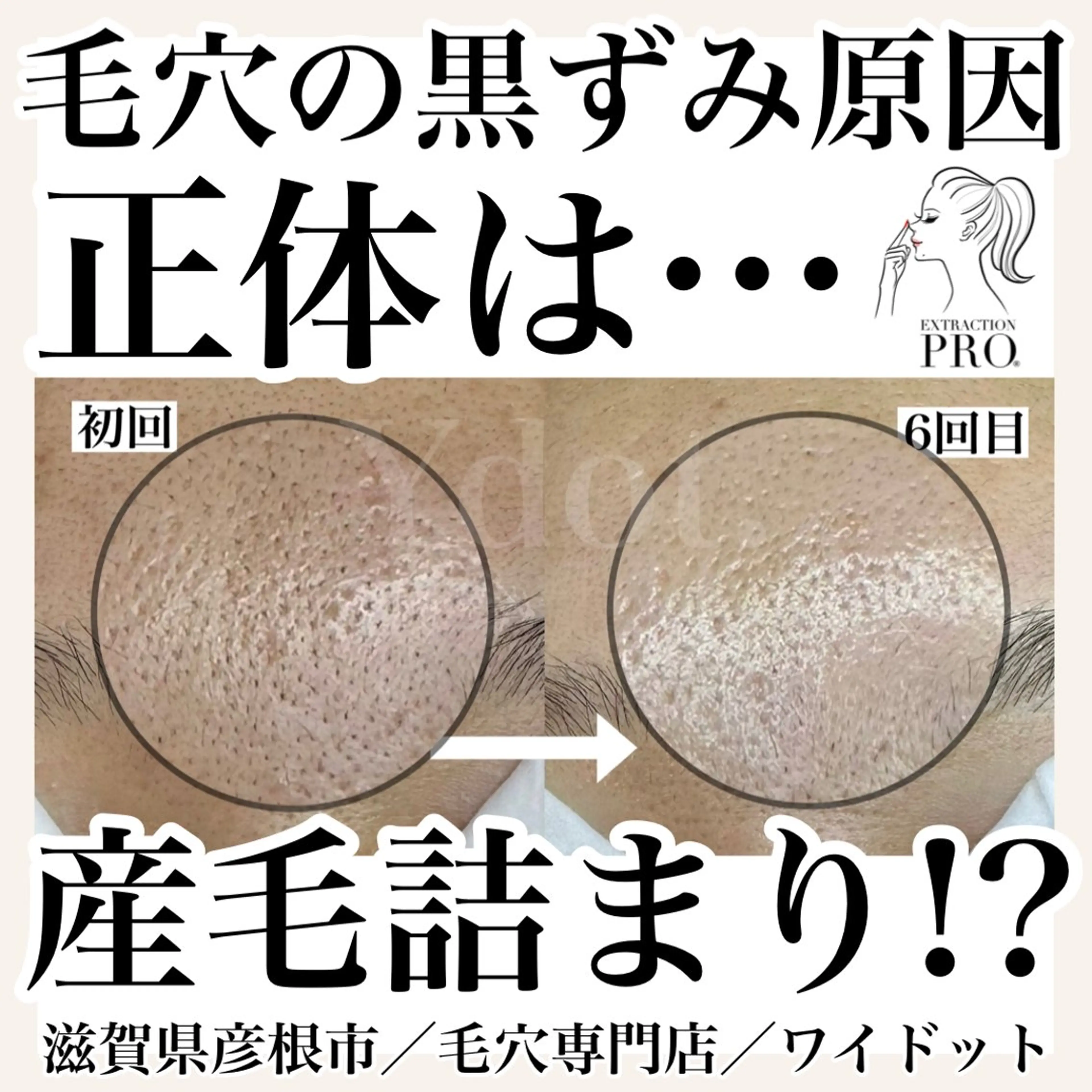 エステ Ydot. 池内 友架のエステ・リラクイメージ