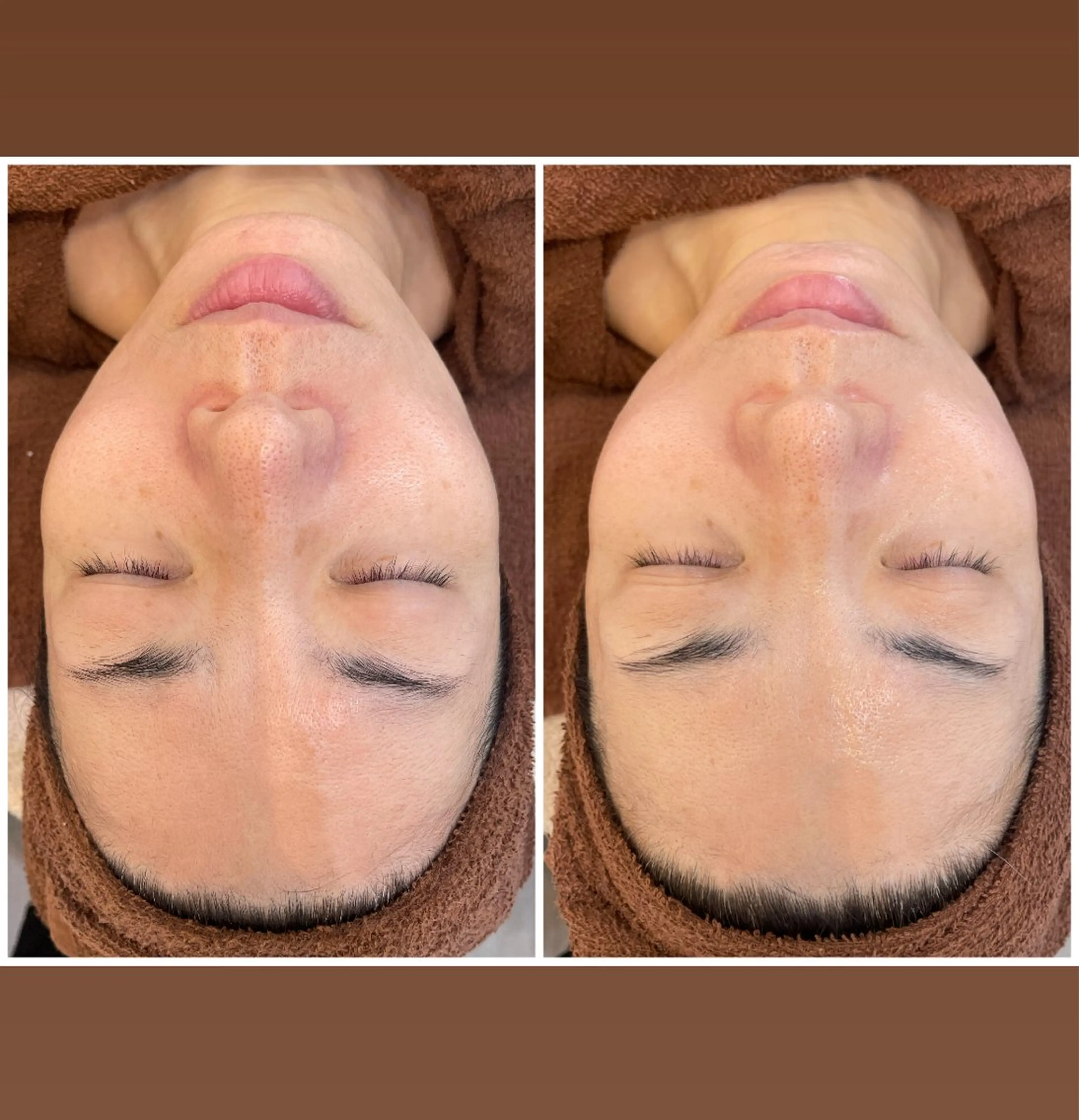 その他 パーソナルスキンケア 🦋APRI🅿️有のエステ・リラクイメージ