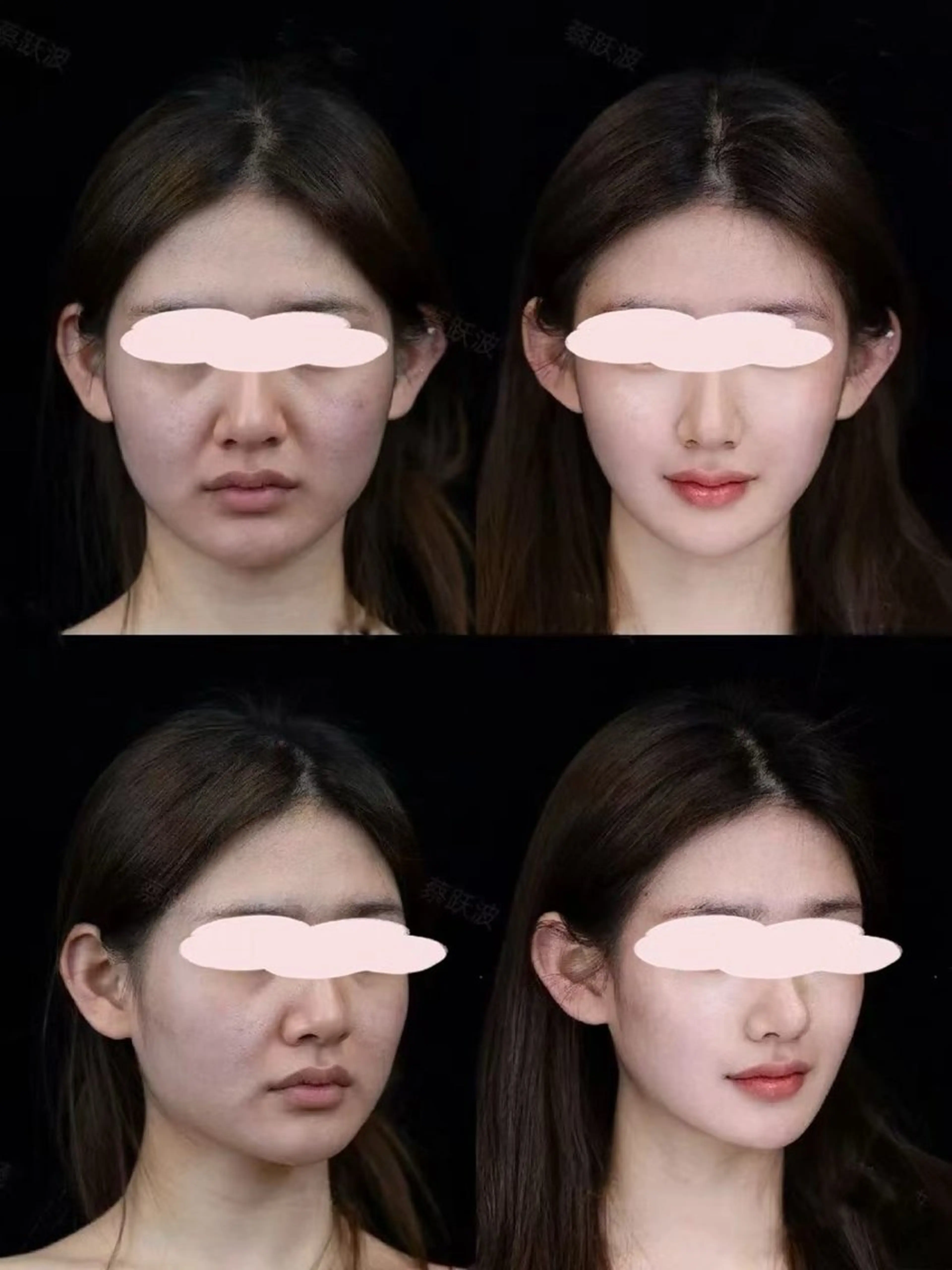 ショート aliaハーブ水光店 エステティシャン募集のエステ・リラクイメージ