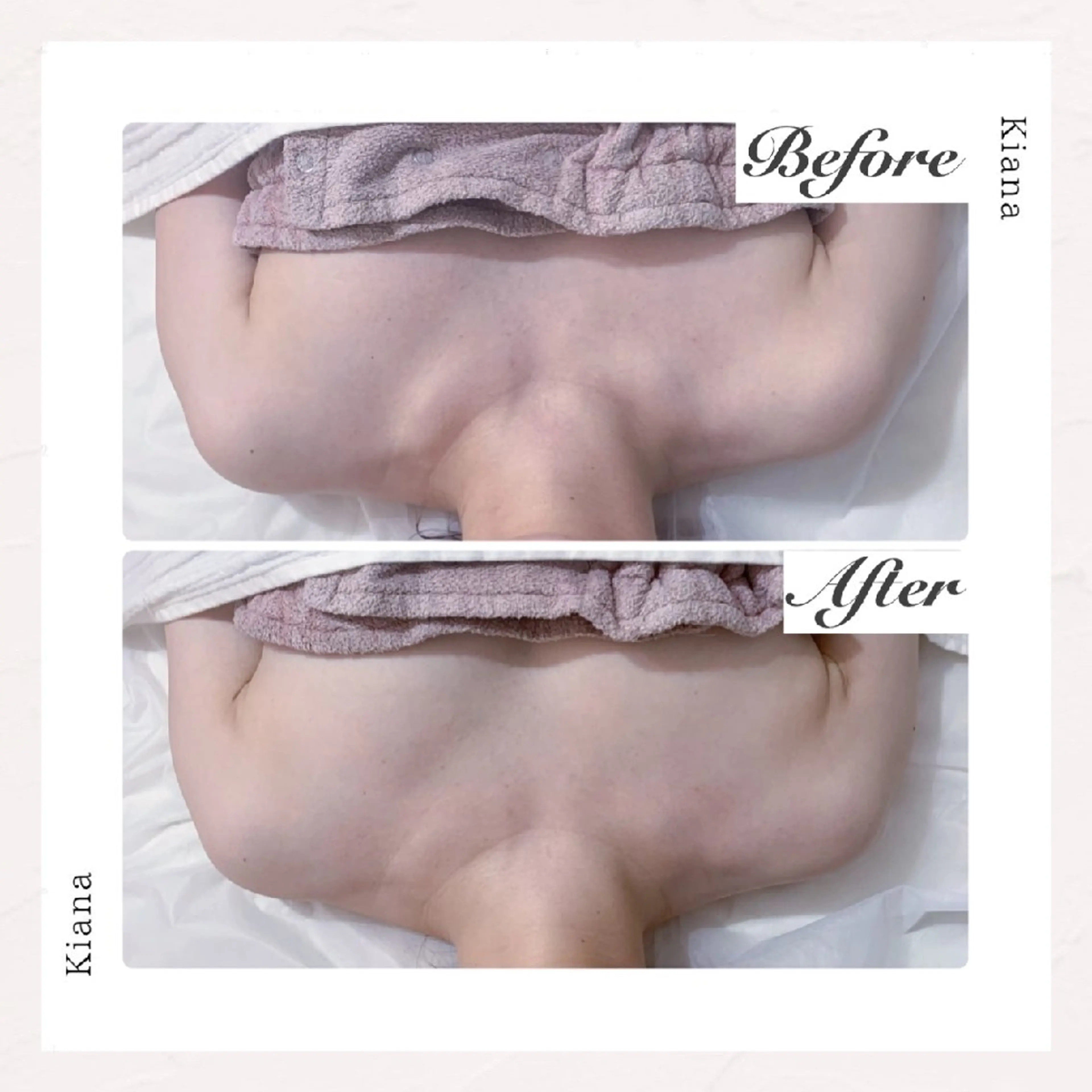 【バスト専門店 】 Kiana のエステ・リラクイメージ