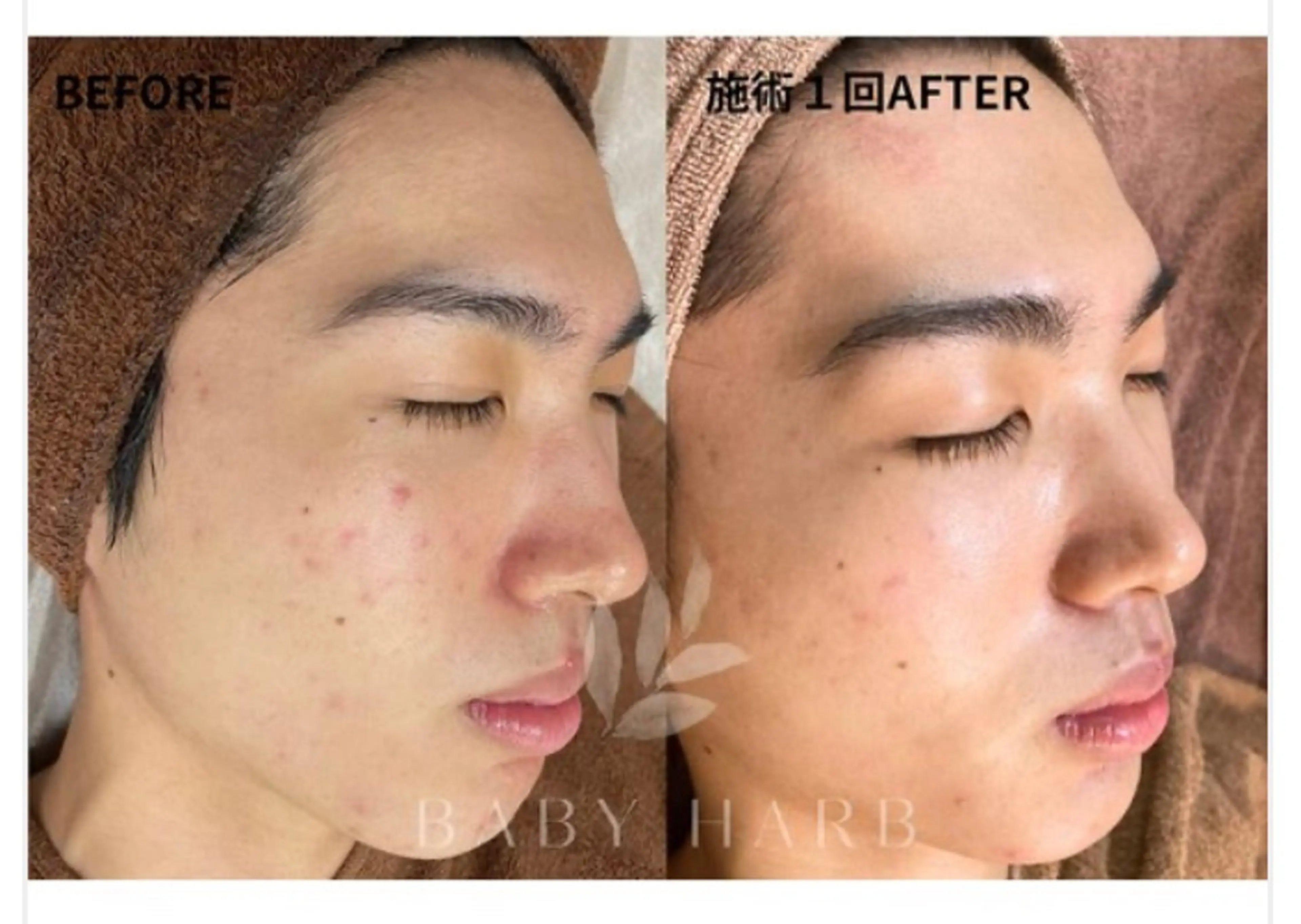 脱毛サロン FIS大和店のエステ・リラクイメージ