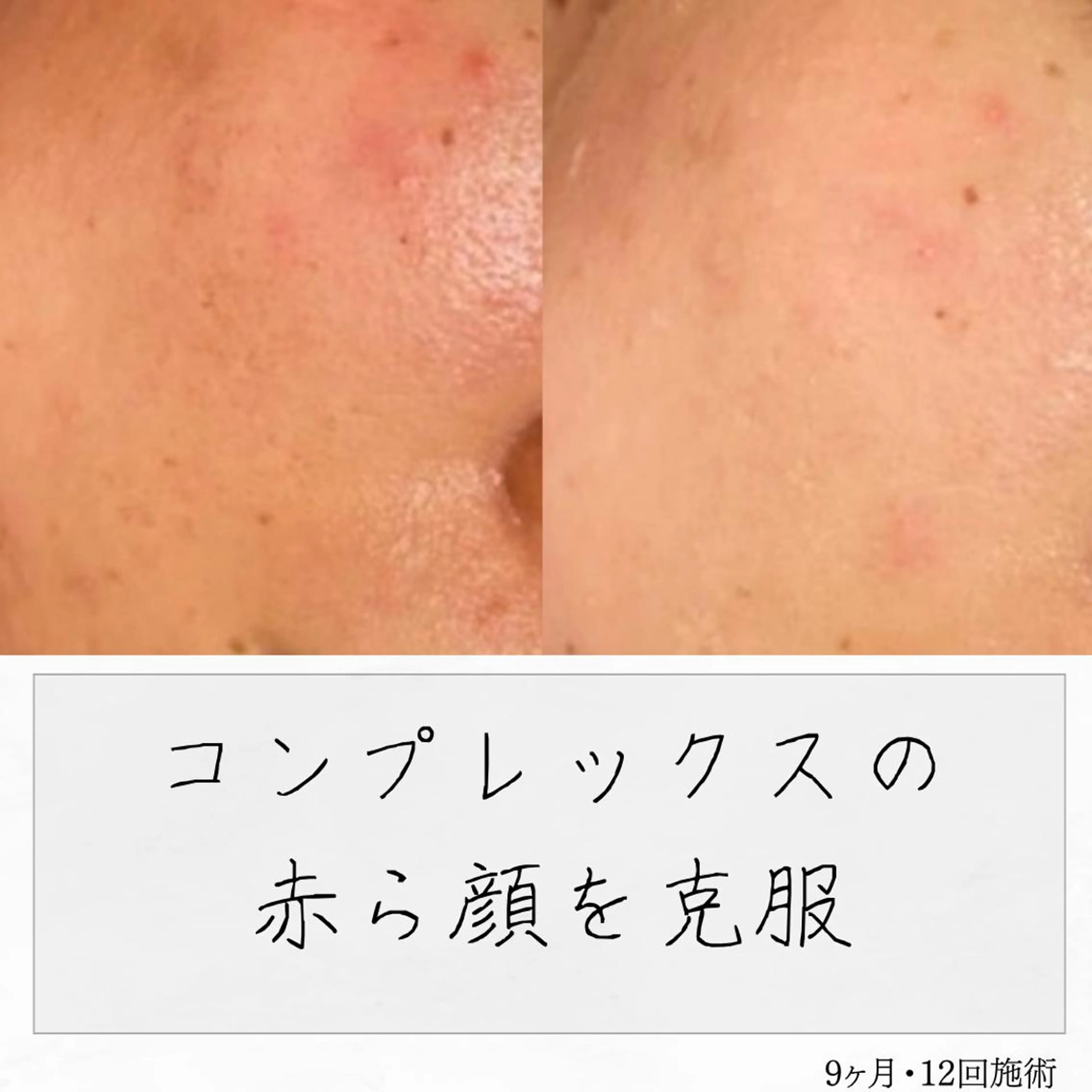 ニキビ経験者が施術 する専門サロン🌻のエステ・リラクイメージ