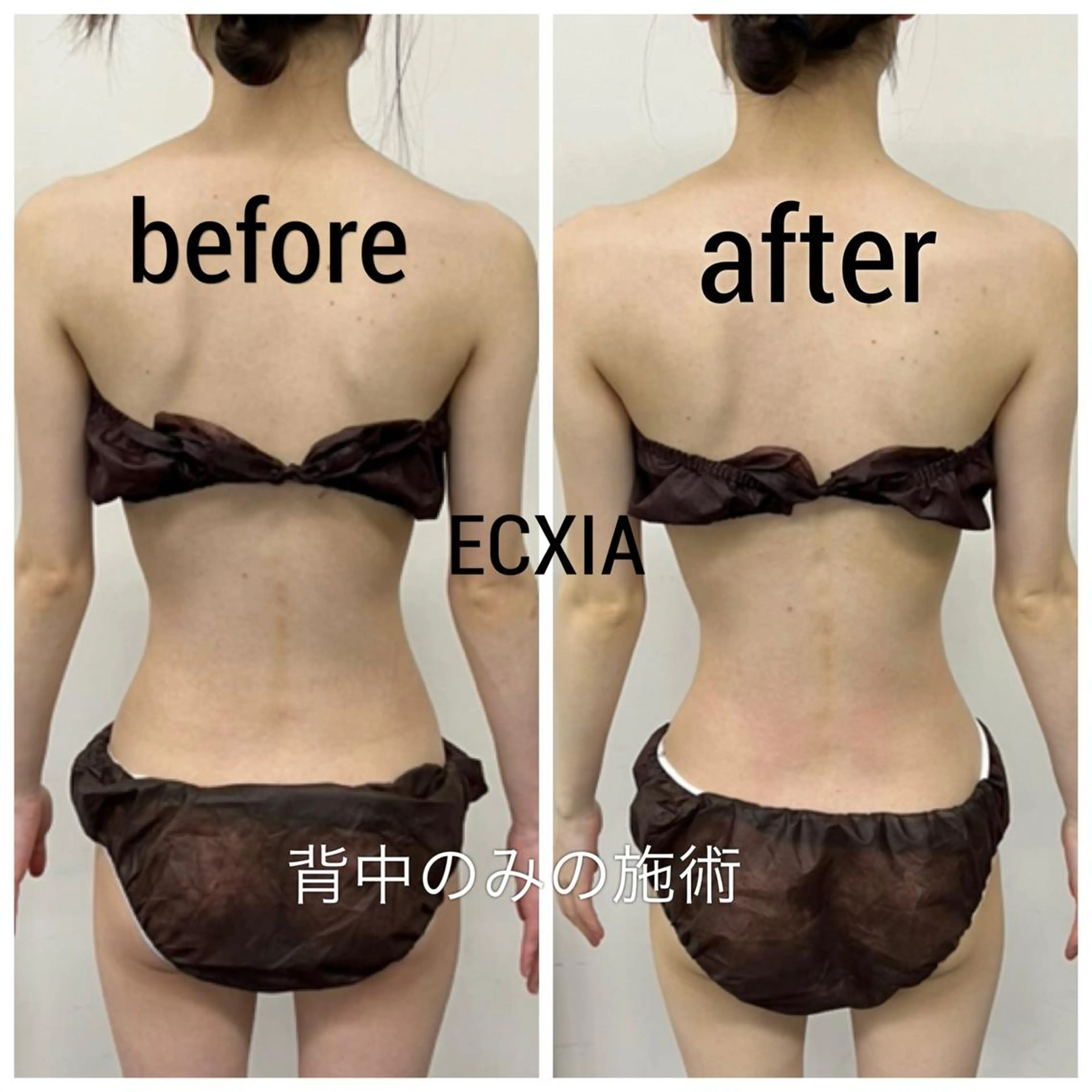 【背中対策集中メニュー！】背中のみオールハンドでマッサージ♡背中痛い方・猫背・肩凝りにオススメ！の写真