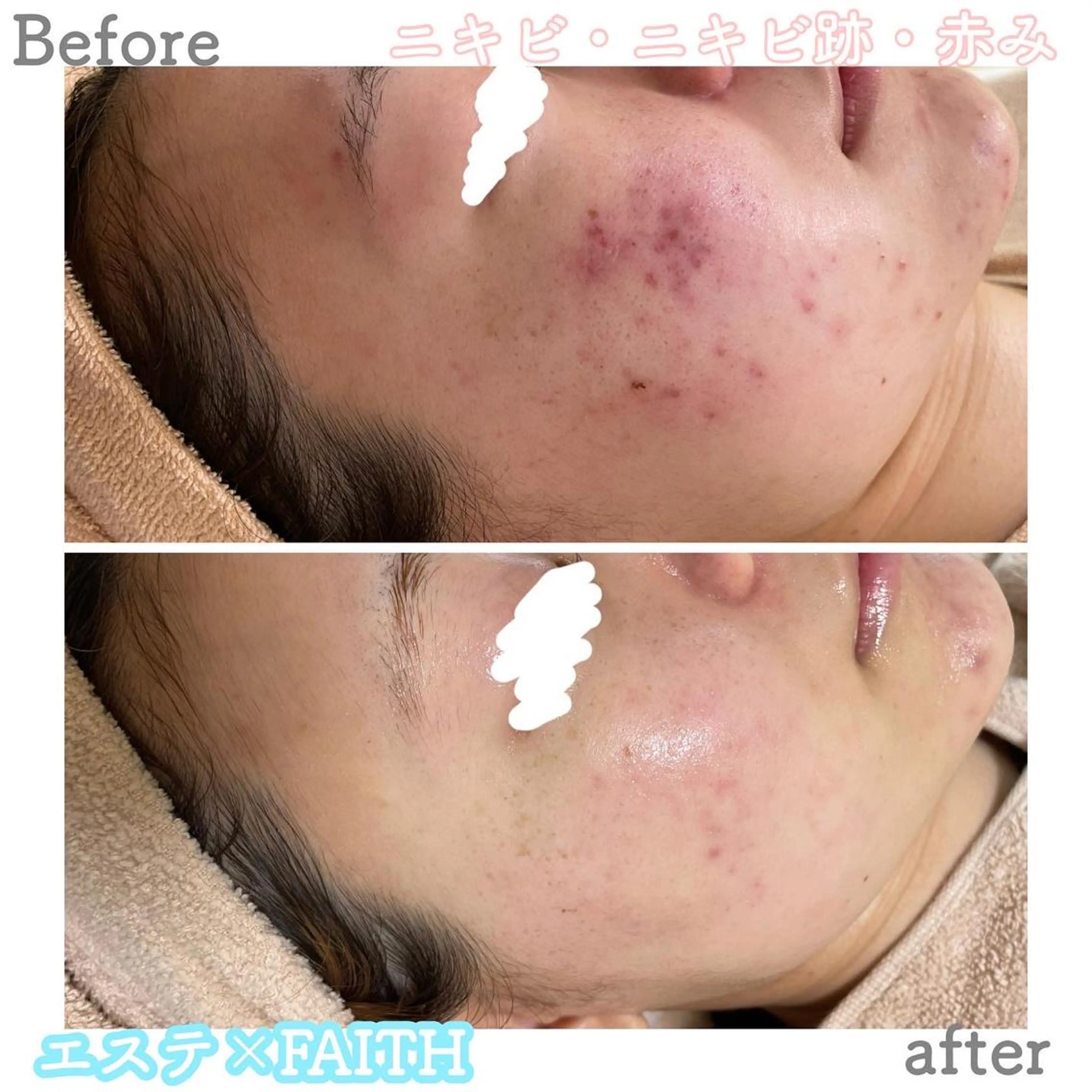 セミロング カラー パーマ ヘアアレンジ メンズ キッズ ネイル マツエク・マツパ アイブロウ ニキビ&跡改善サロン オーナー光木のエステ・リラクイメージ