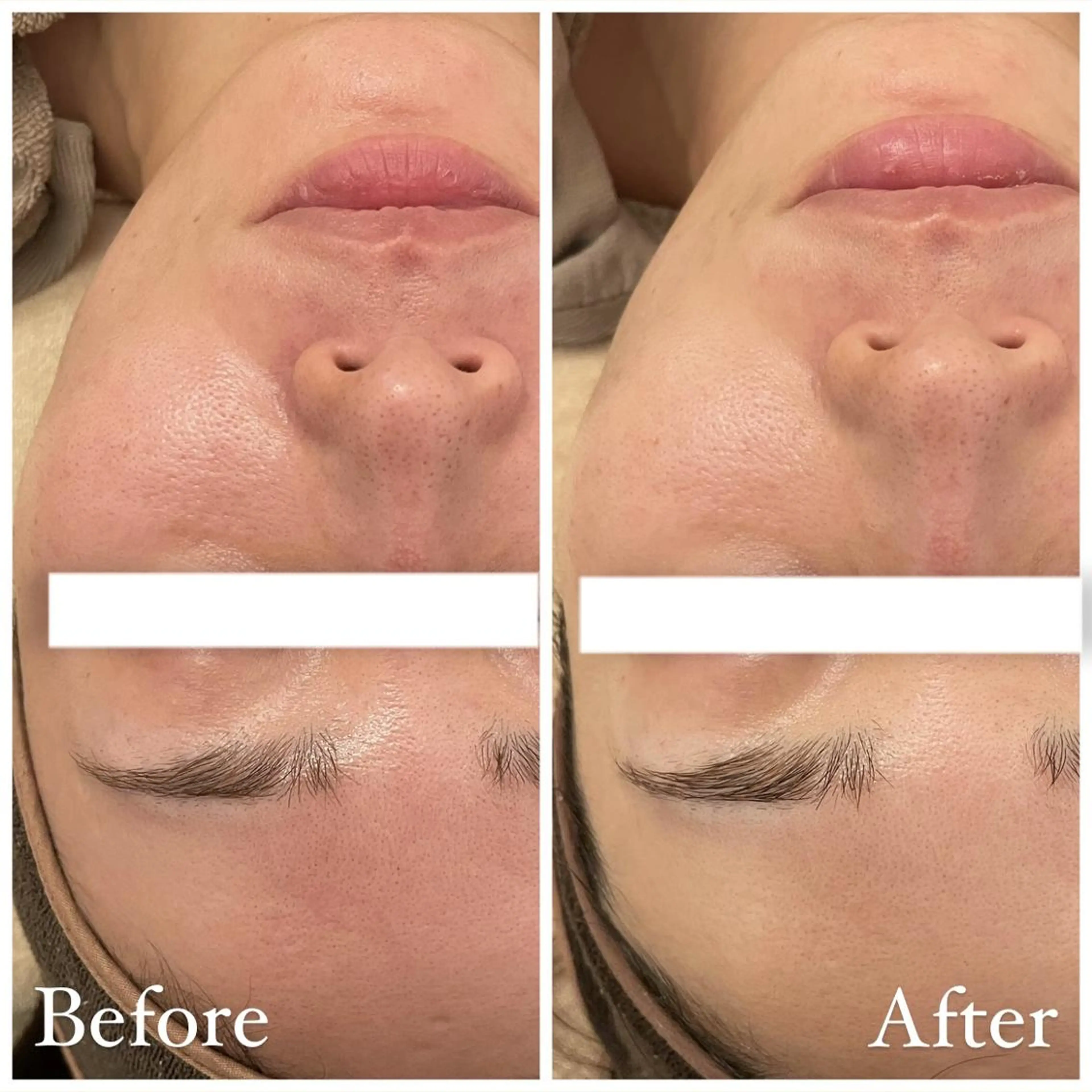 エステ ララ/ハーブ メゾンリュバンのエステ・リラクイメージ