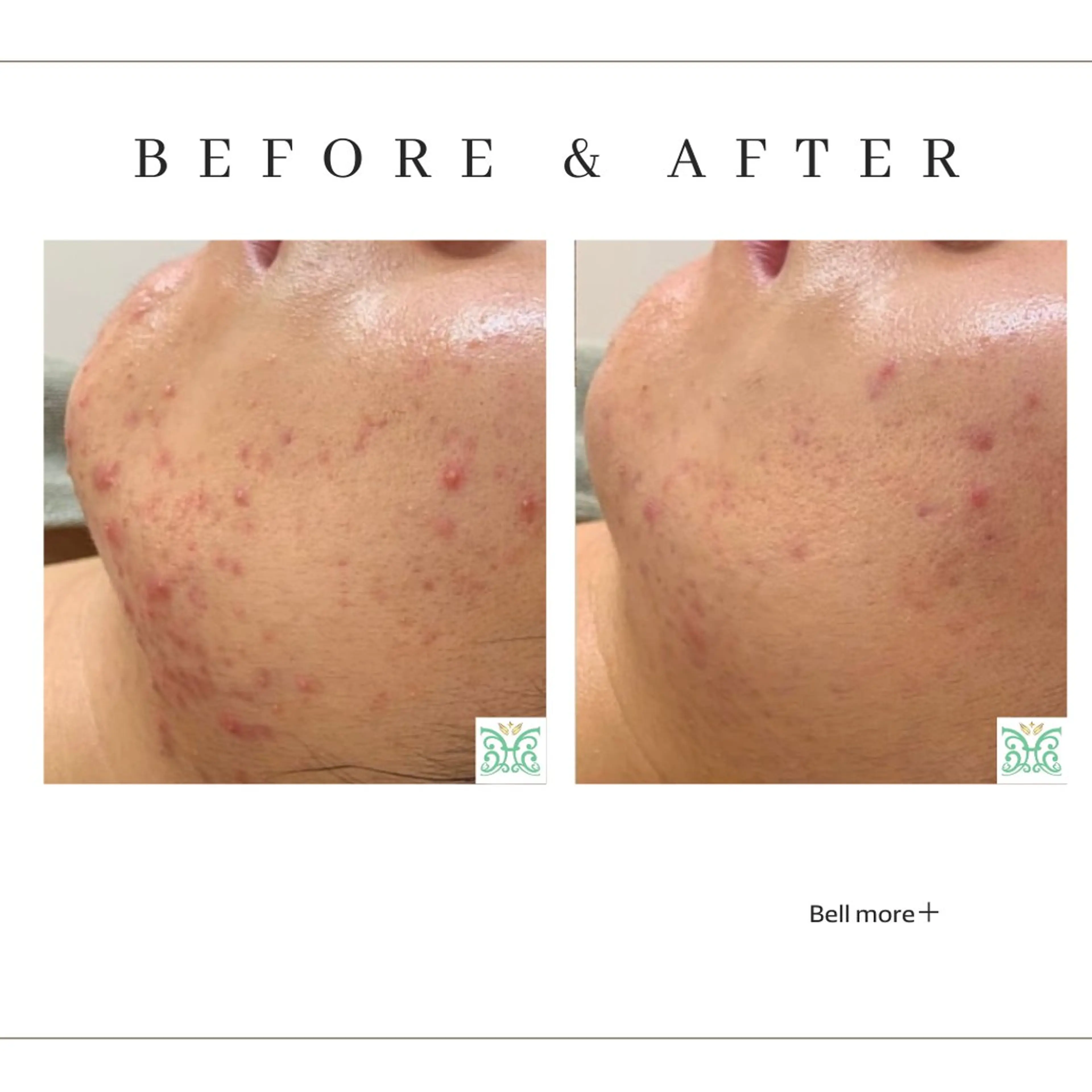 Bellmore ＋のエステ・リラクイメージ