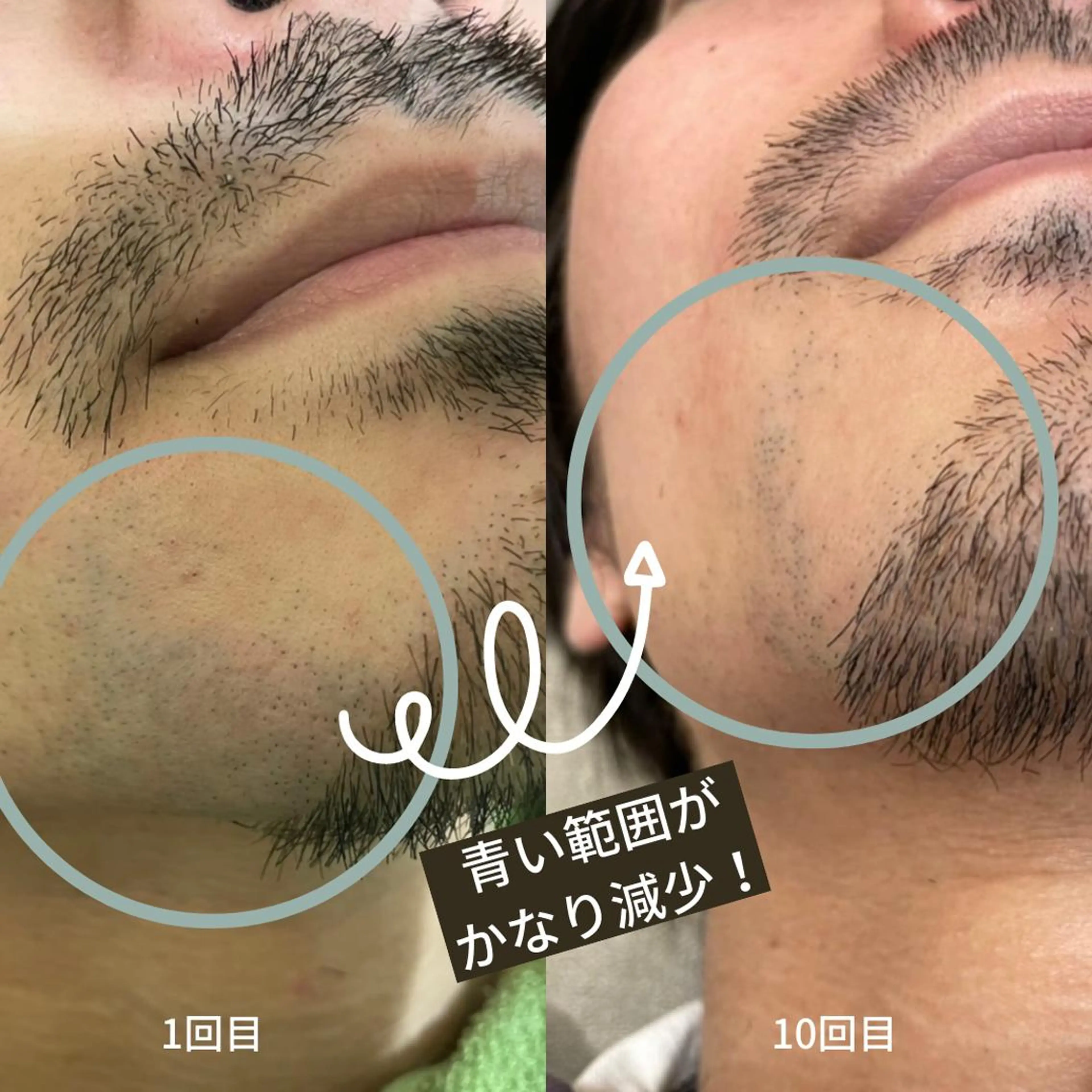 DUPE&MORE 店長kanaeのエステ・リラクイメージ