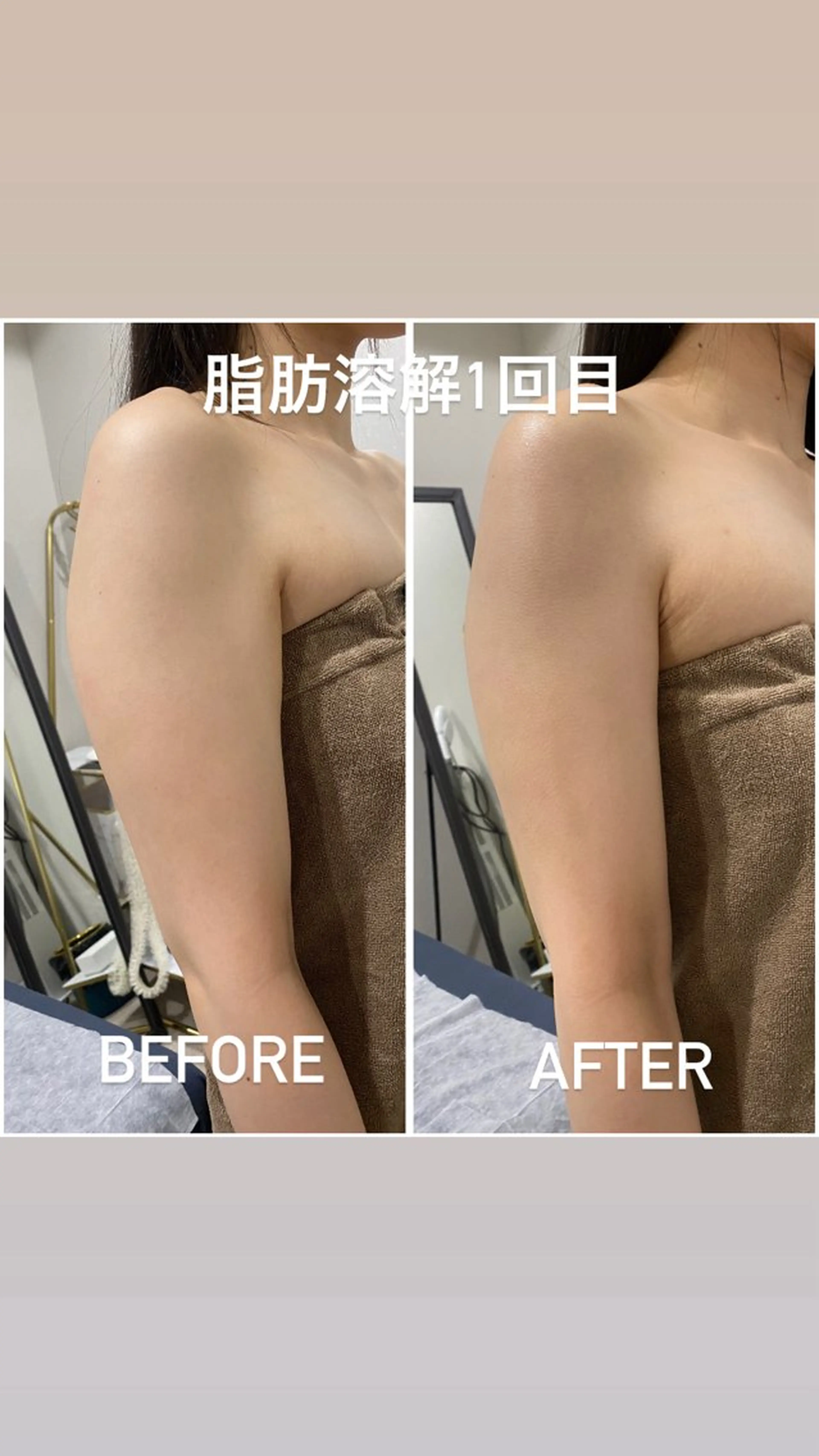 エステ 毛穴洗浄・痩身・脱毛 /アルカンジュのエステ・リラクイメージ