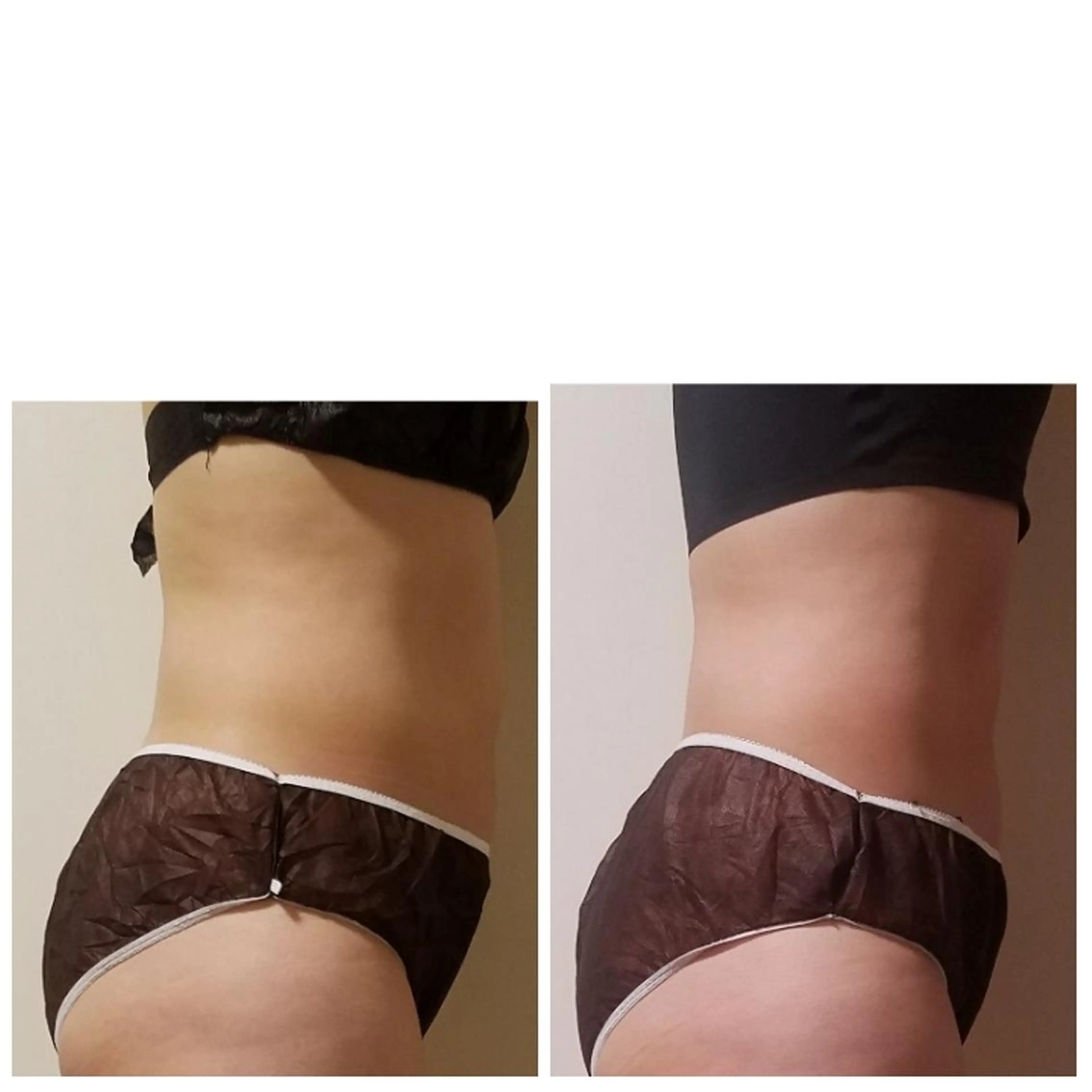 エステ 杉山 恵子のエステ・リラクイメージ