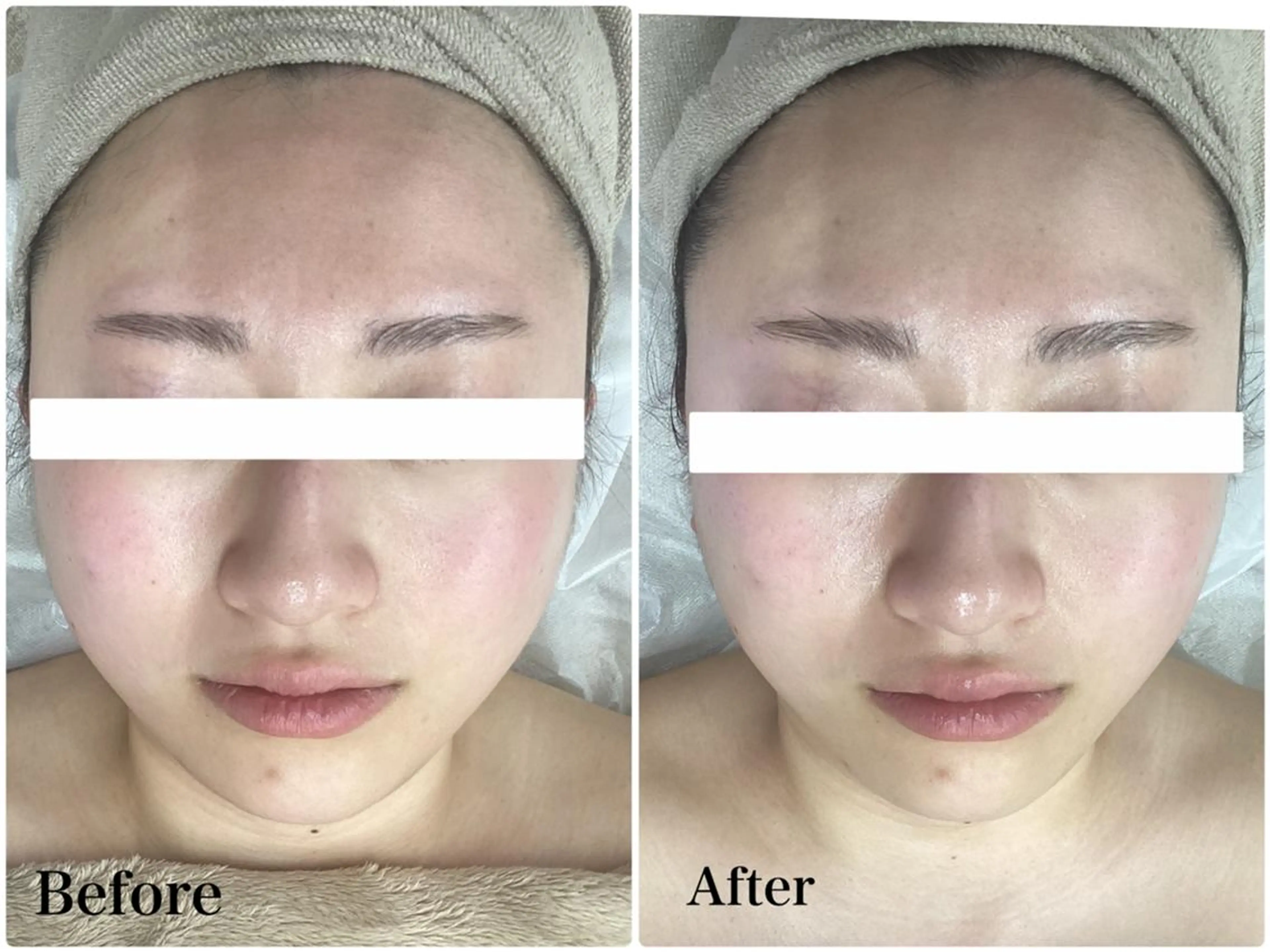 パーソナルエステ L'purのエステ・リラクイメージ