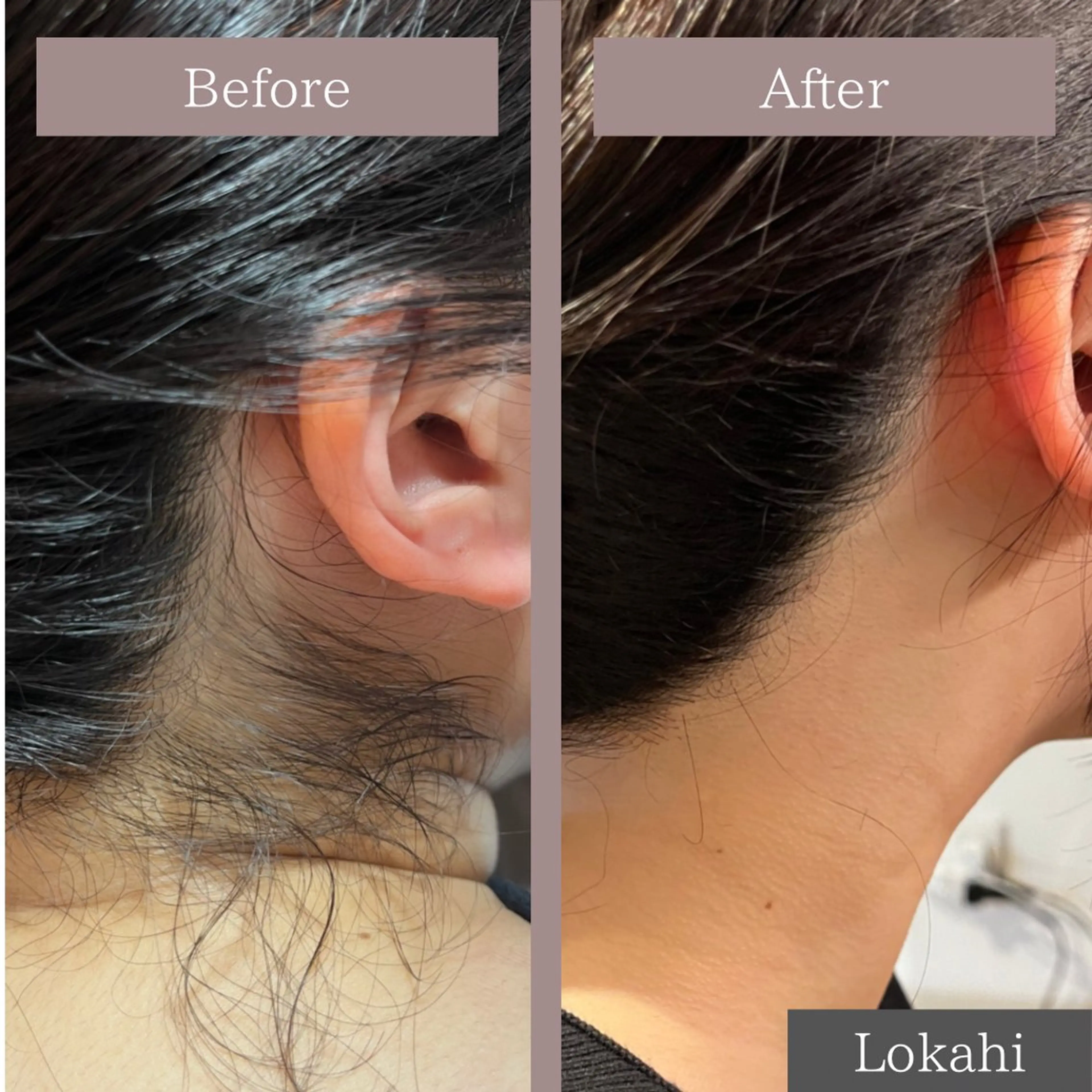 Lokahi所属・全身脱毛/リラク Lokahiのエステ・リラクイメージ