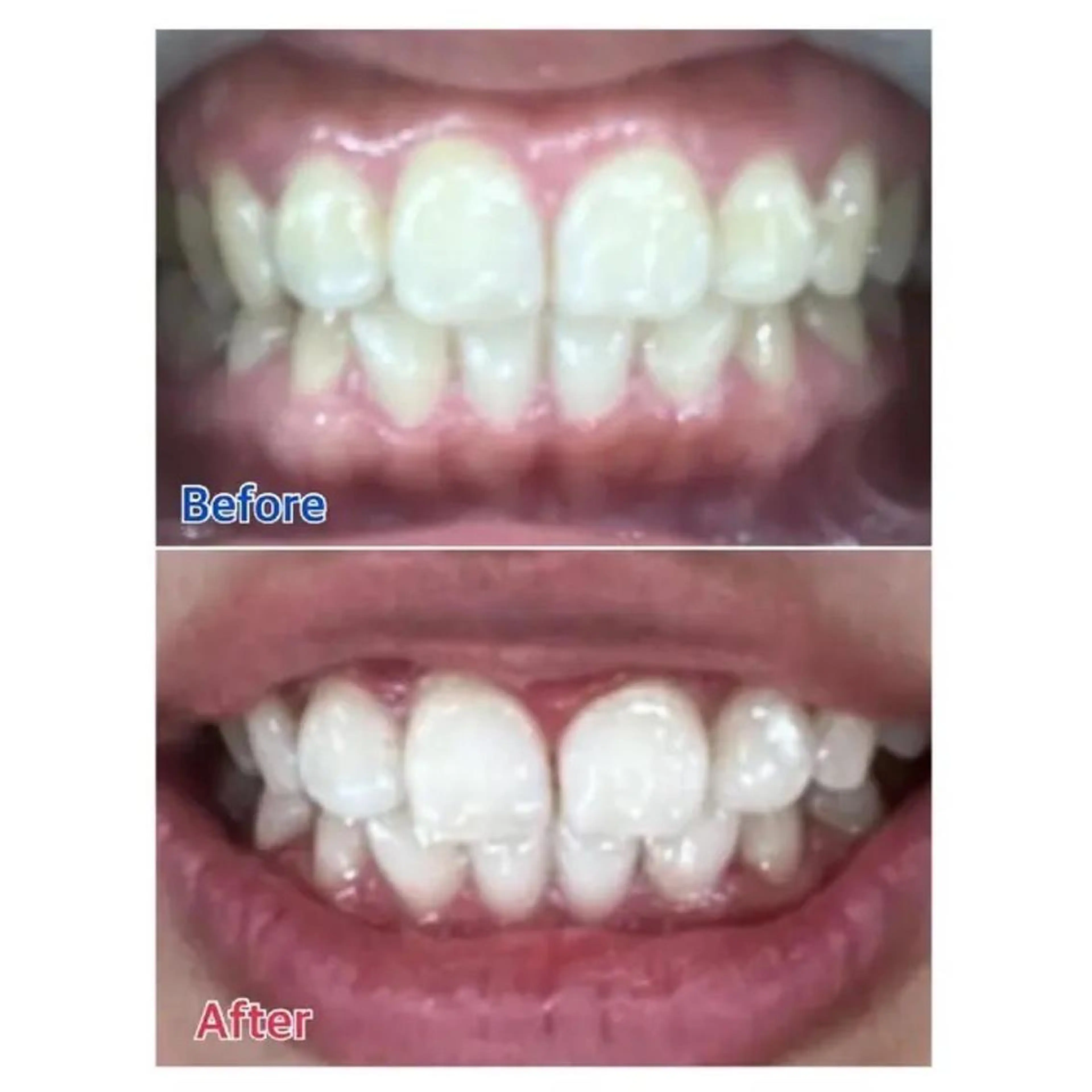 M渋谷 ホワイトニングのエステ・リラクイメージ