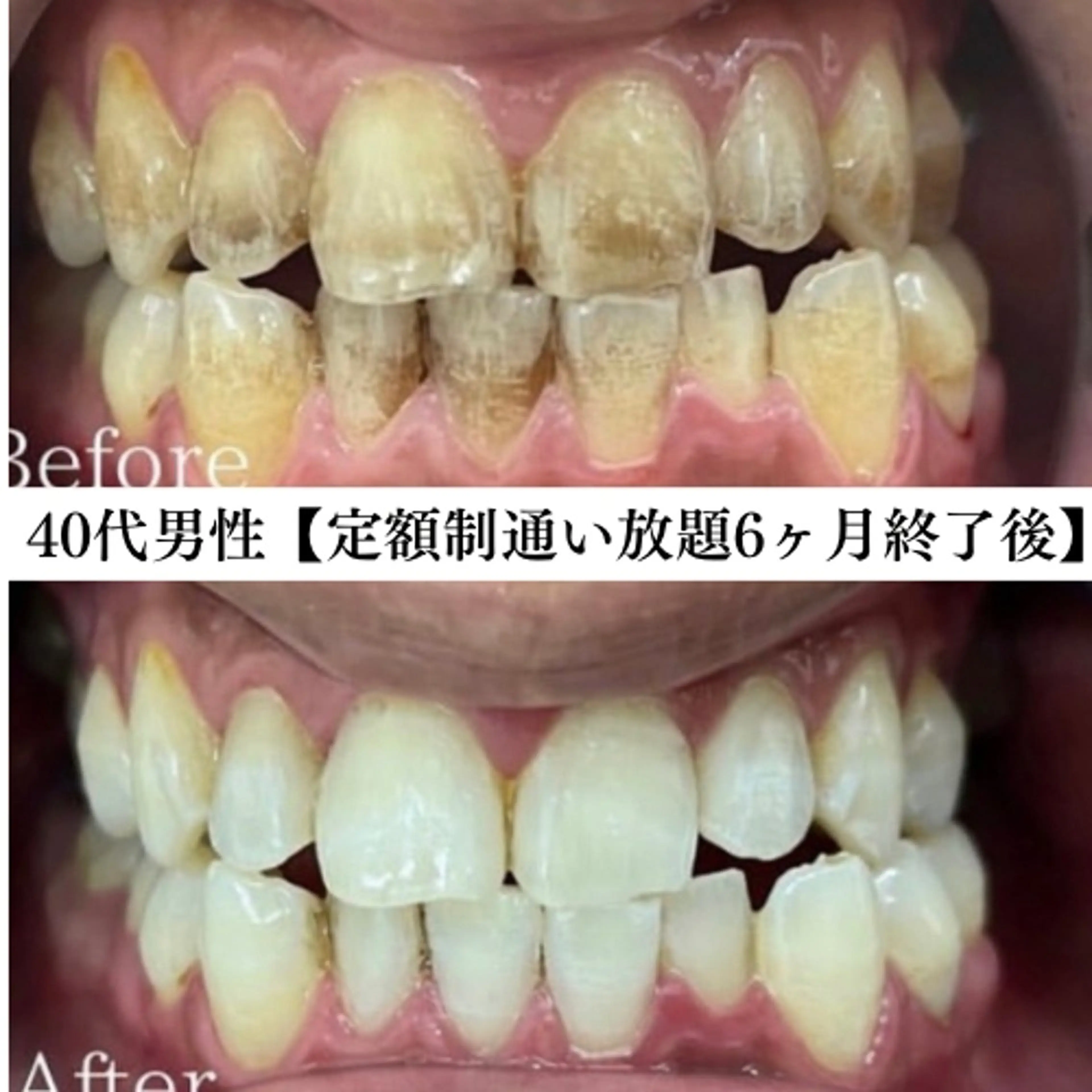 メンズ エステ リラク セルフホワイトニング WHITE福岡天神店のエステ・リラクイメージ