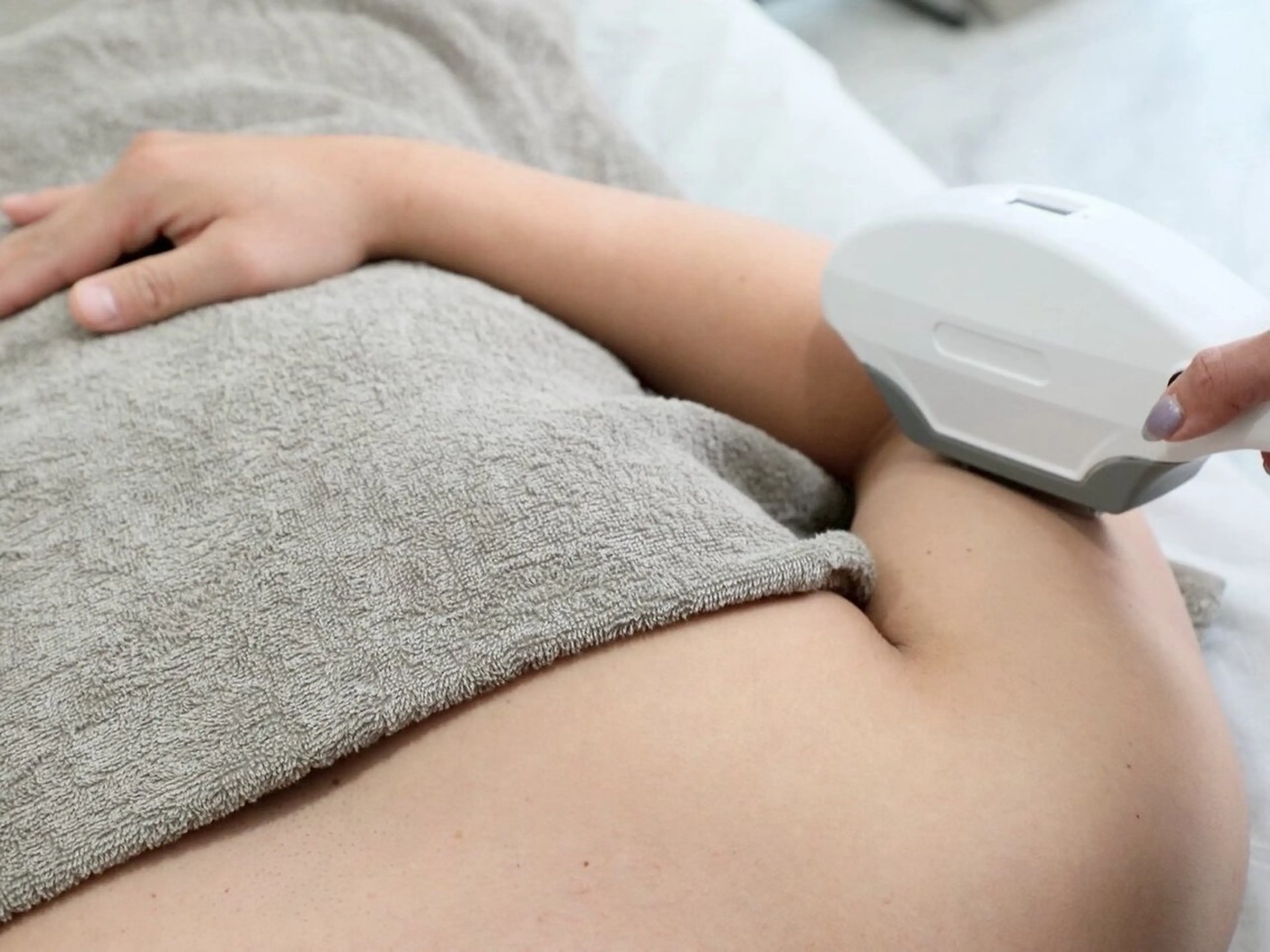 Open記念【メンズ脱毛/腕脱毛】長袖の間に腕脱毛で清潔感UP　　9900→2450の写真