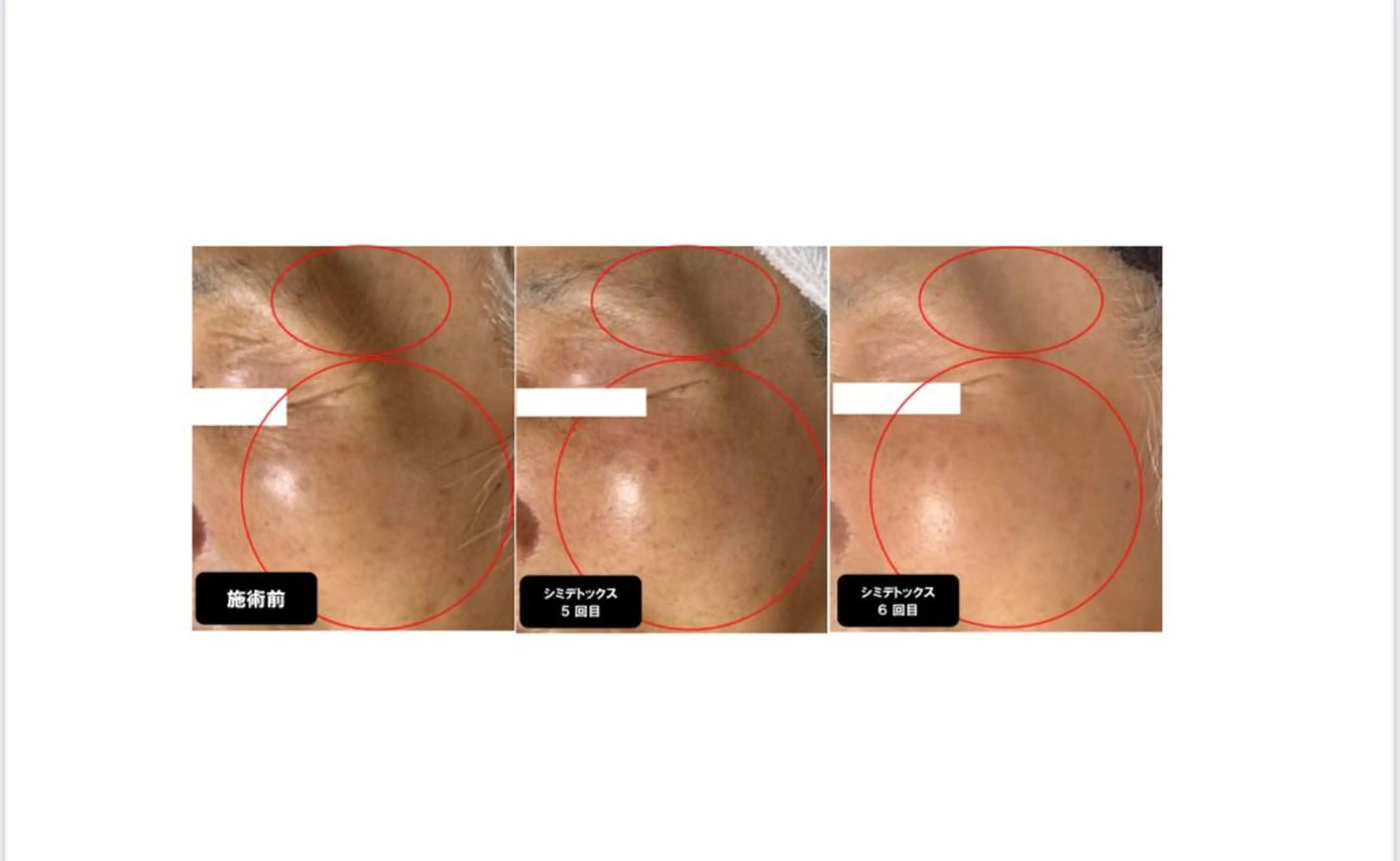 エステ ヴィーナス ビューティーのエステ・リラクイメージ