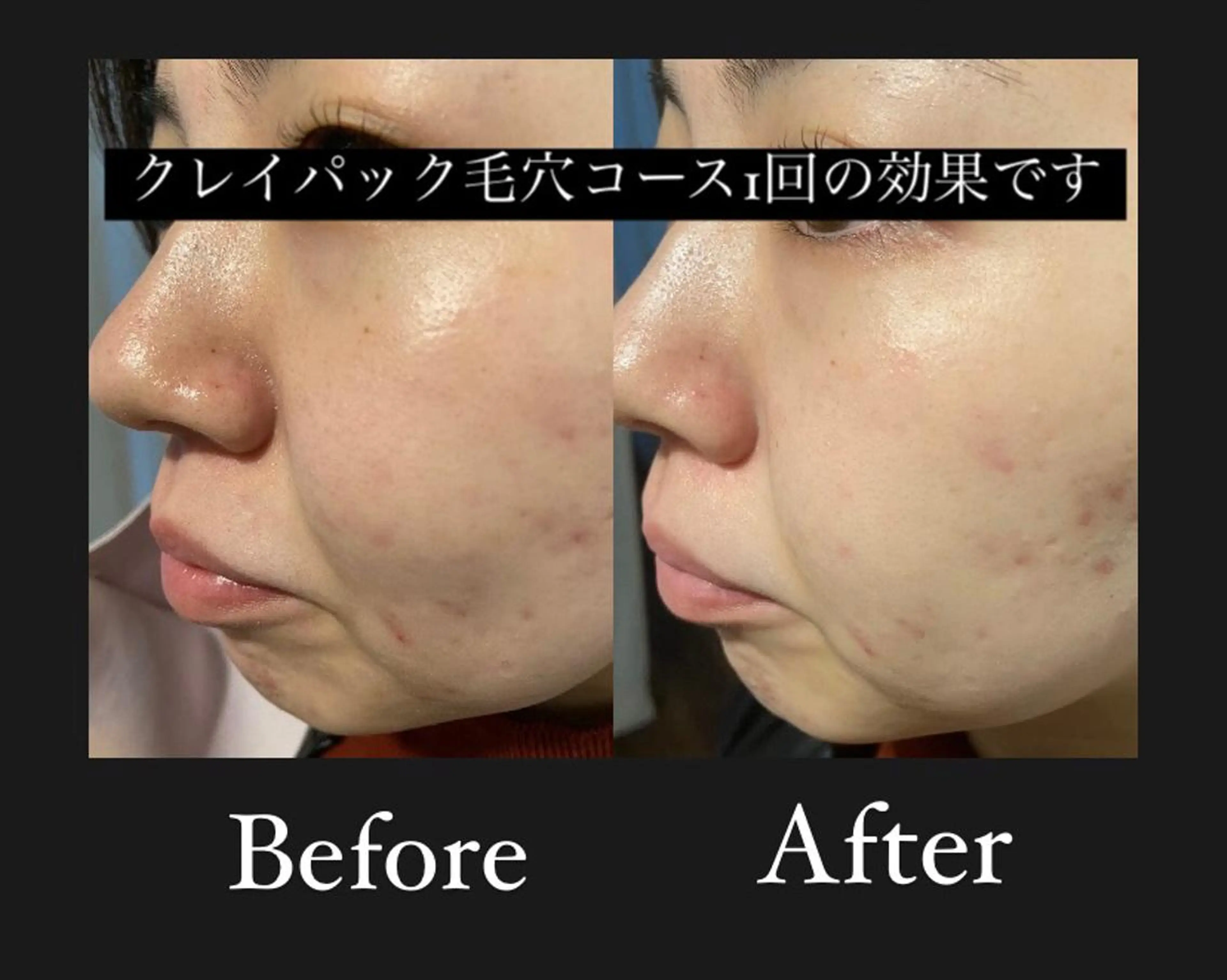 よもぎ蒸し専門店 Artemisiaのエステ・リラクイメージ