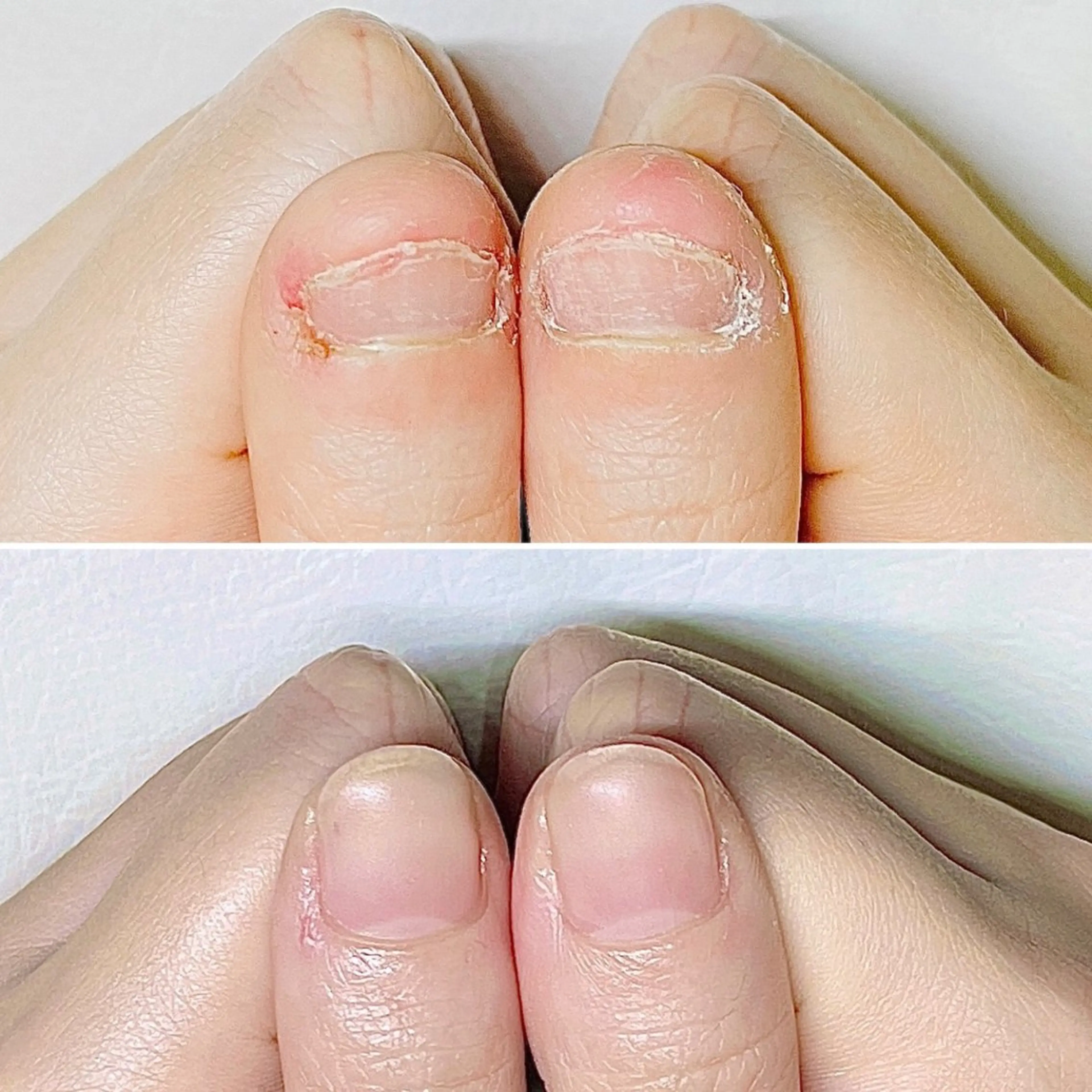 ネイル 深爪・巻き爪 専門サンセリテのネイルデザイン