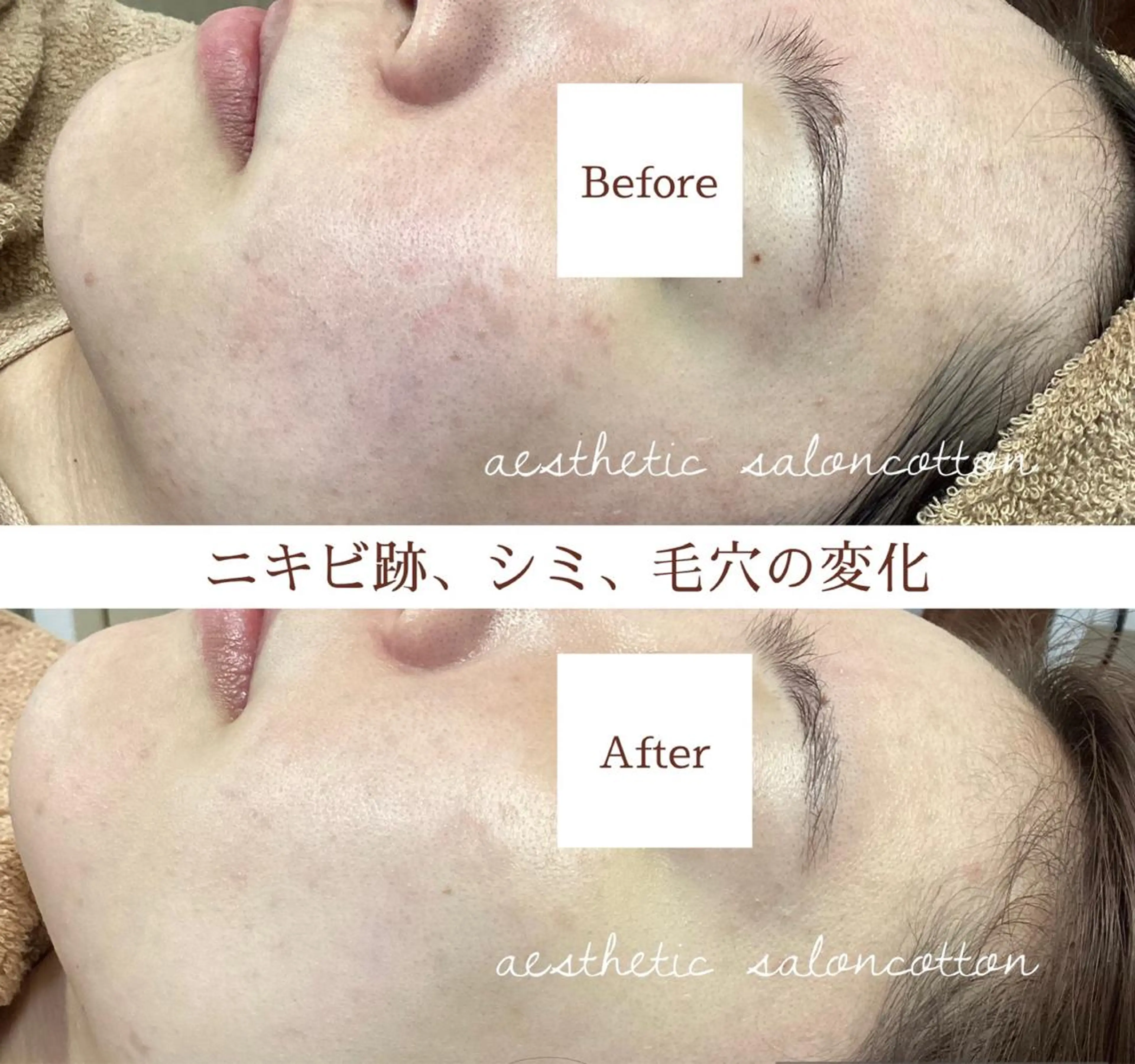 エステ 都度払い 肌質改善専門サロンのエステ・リラクイメージ