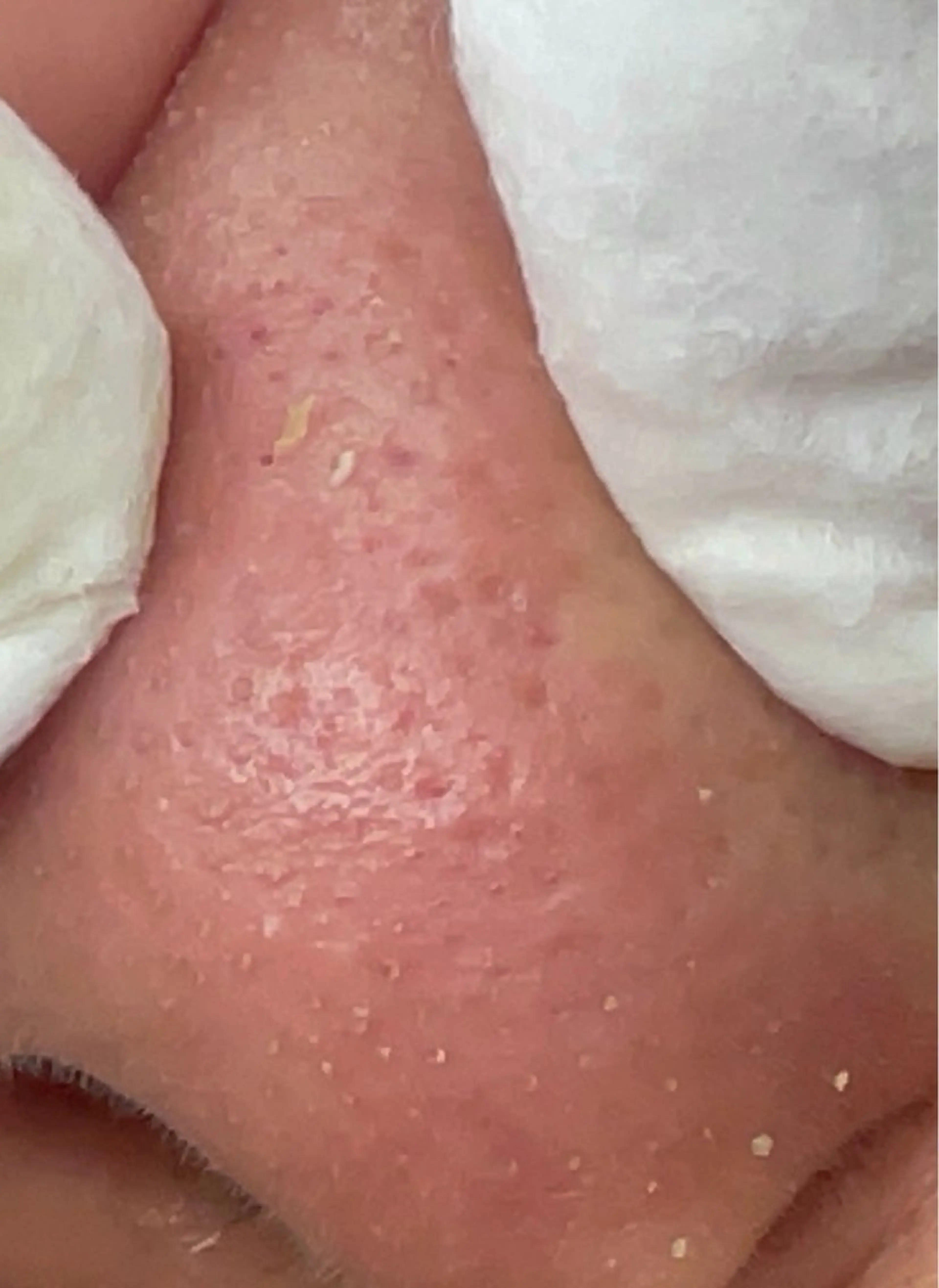 エステ お肌のかかりつけサロンP.A.L.M.所属・【P.A.L.M.】 むき卵×毛穴レス肌のエステ・リラクイメージ