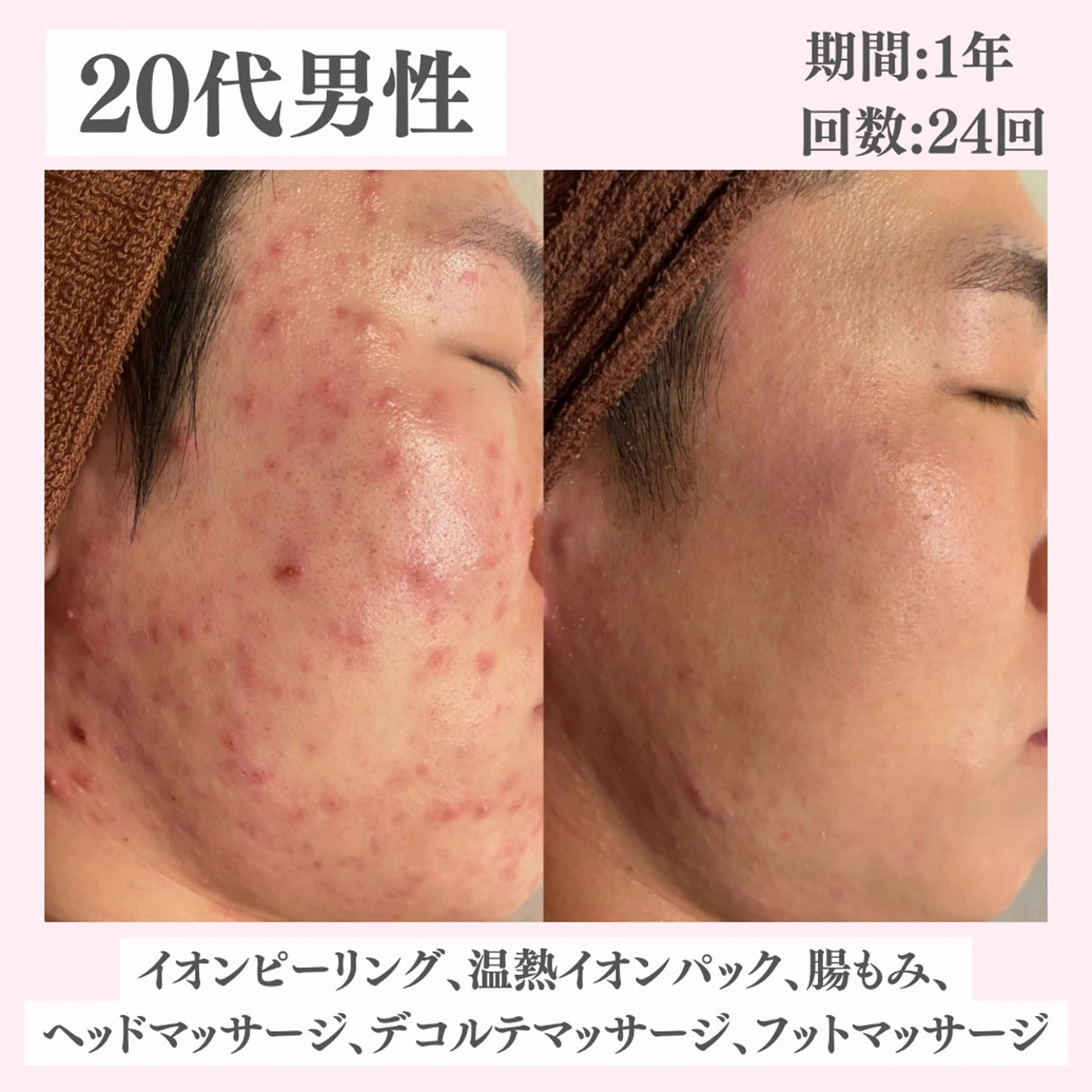 エステ リラク ニキビ・肌質改善専門 ♡人生が変わるサロンのエステ・リラクイメージ