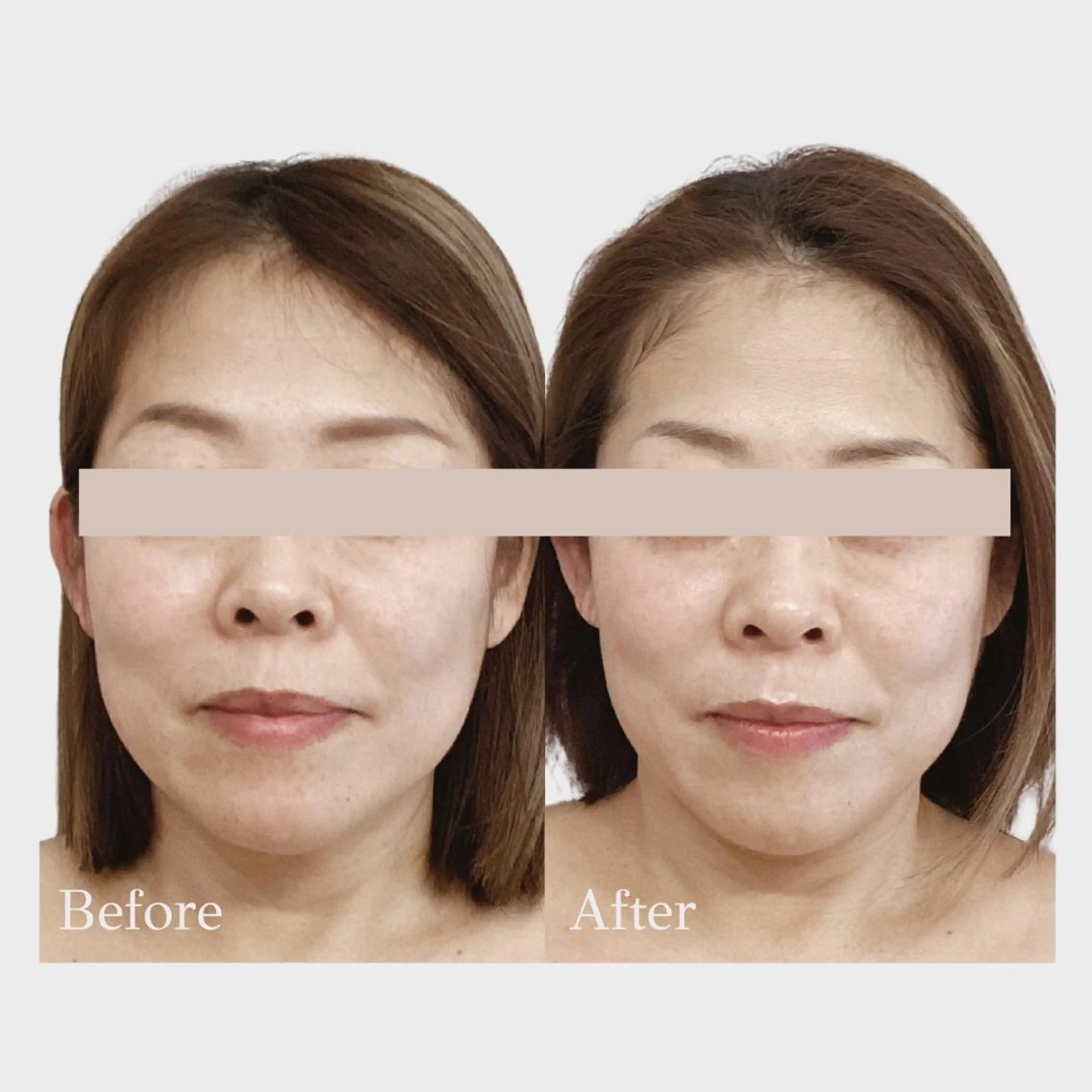 看護師 AYUIのエステ・リラクイメージ