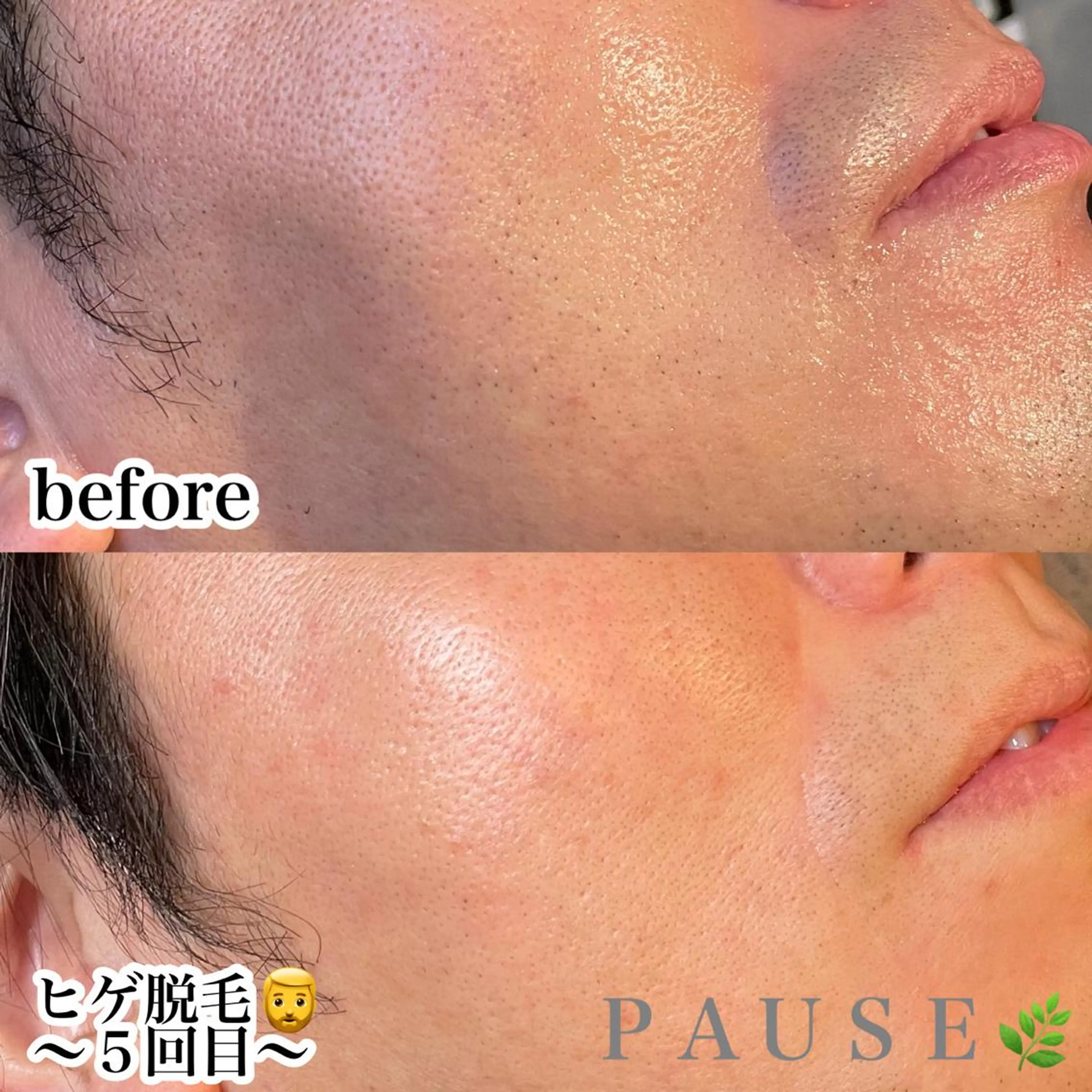 脱毛 浜野 恵美のエステ・リラクイメージ