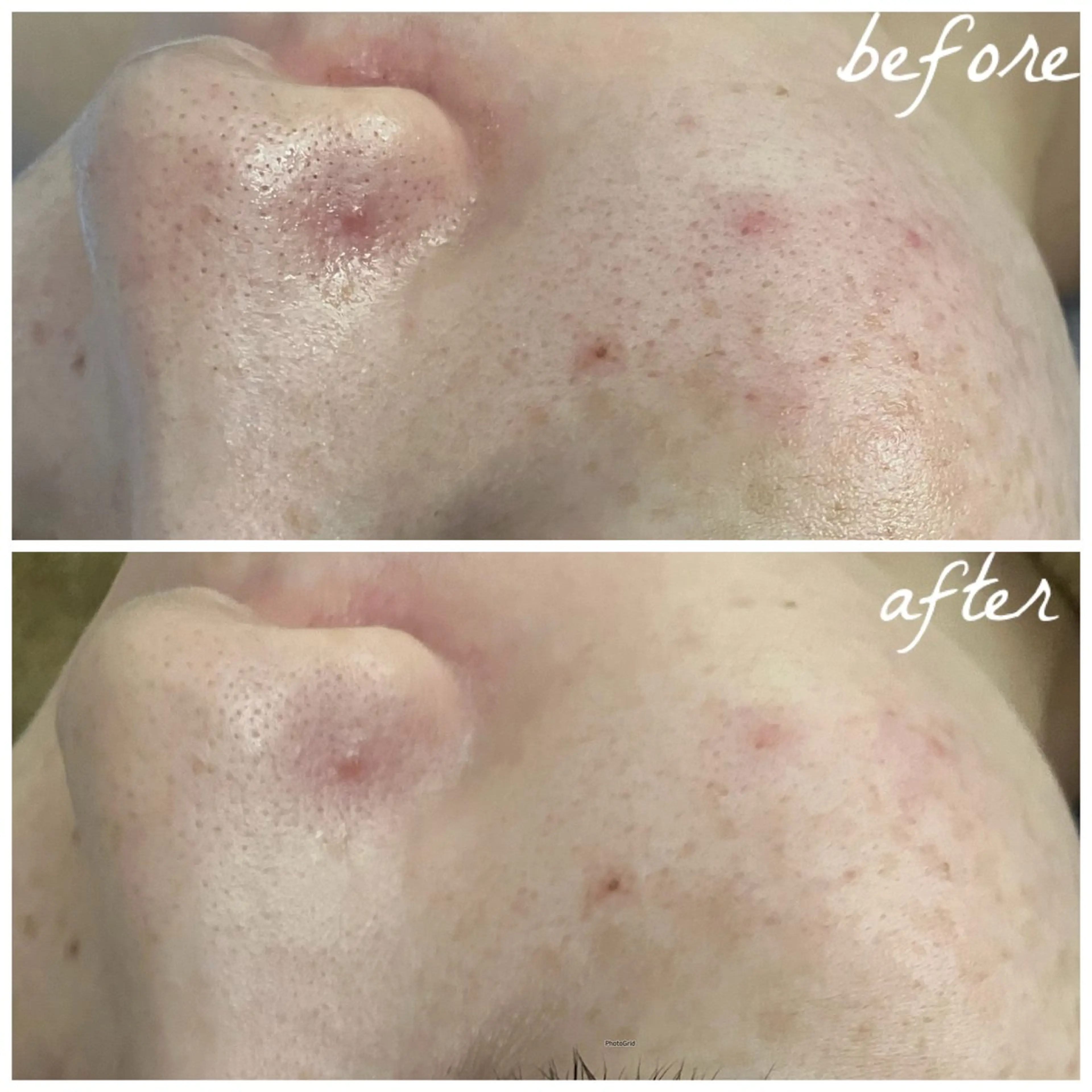 メンズ メナード岐阜茜部 杉浦のエステ・リラクイメージ