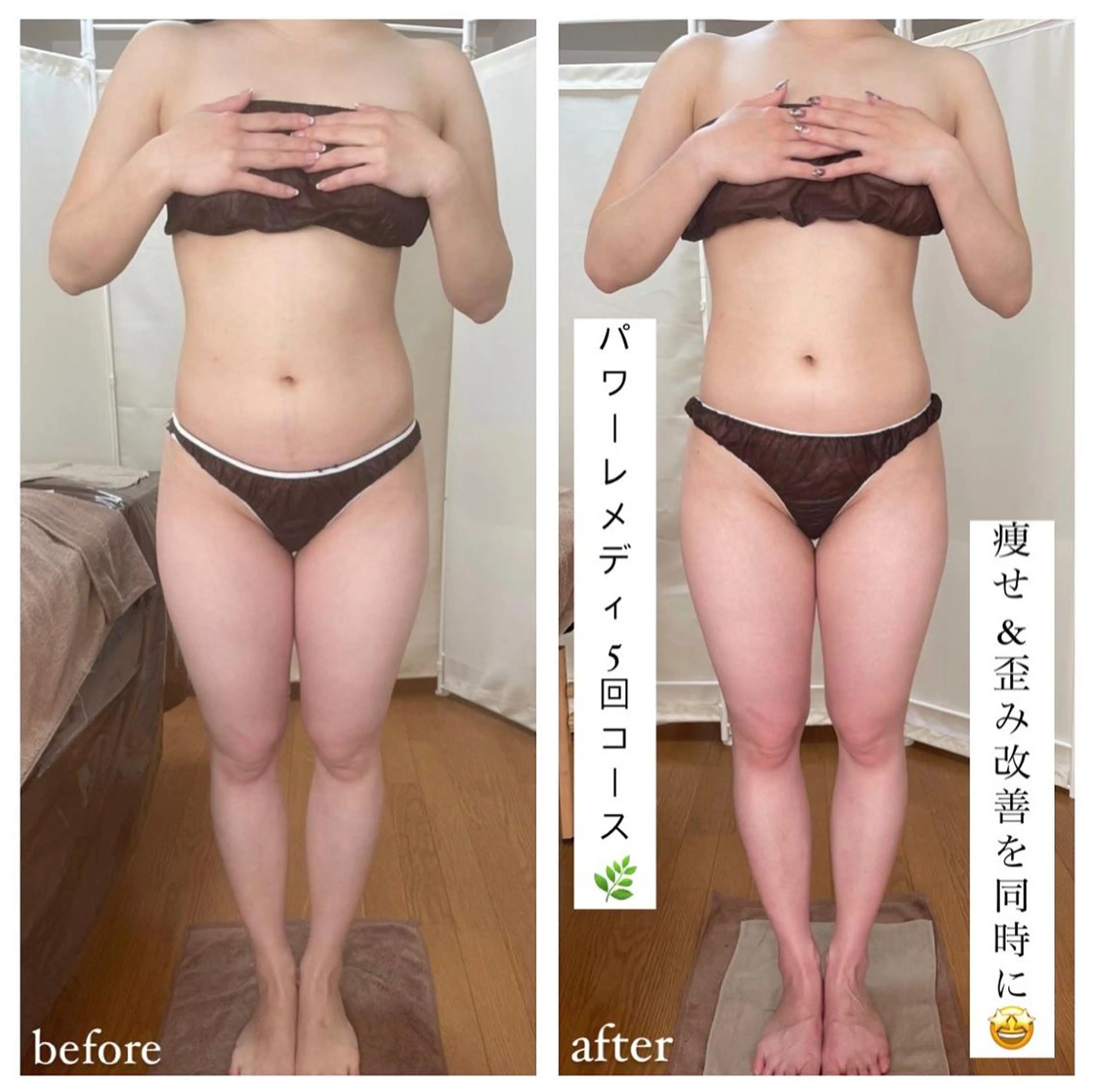 biloop所属・《本気痩せ×疲労改善 》  BILOOPのエステ・リラクイメージ