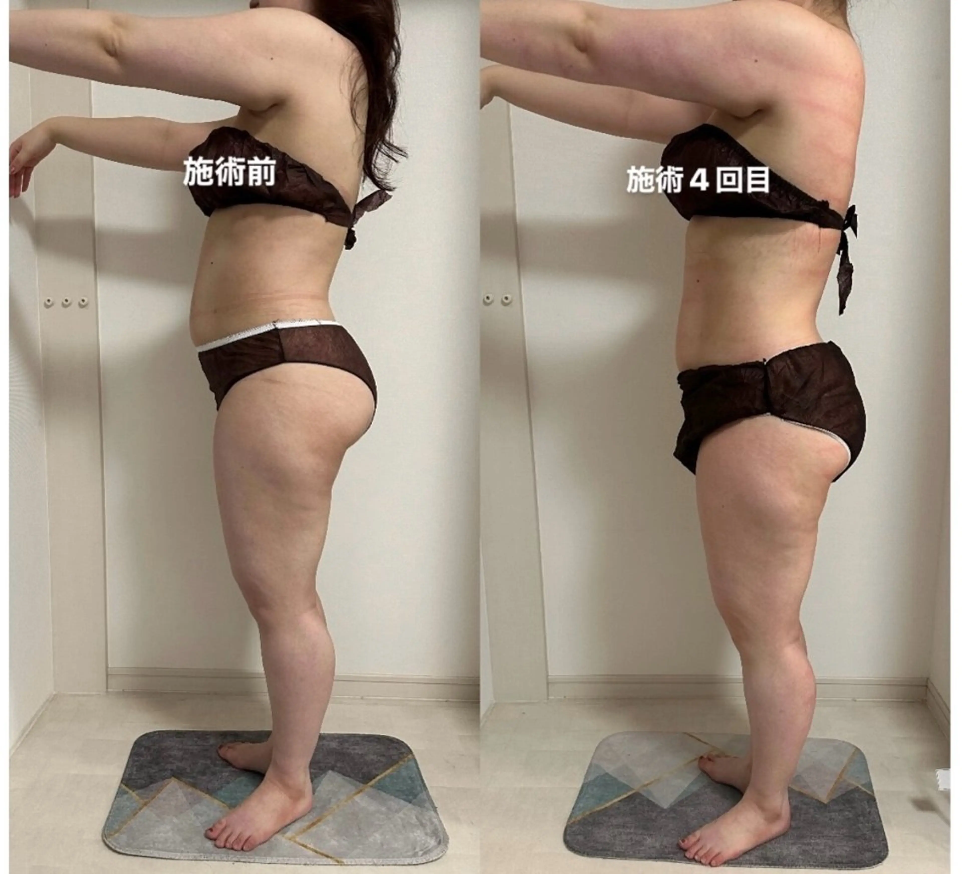 IBERIA心斎橋店 🌼凝り小顔美肌痩身のエステ・リラクイメージ