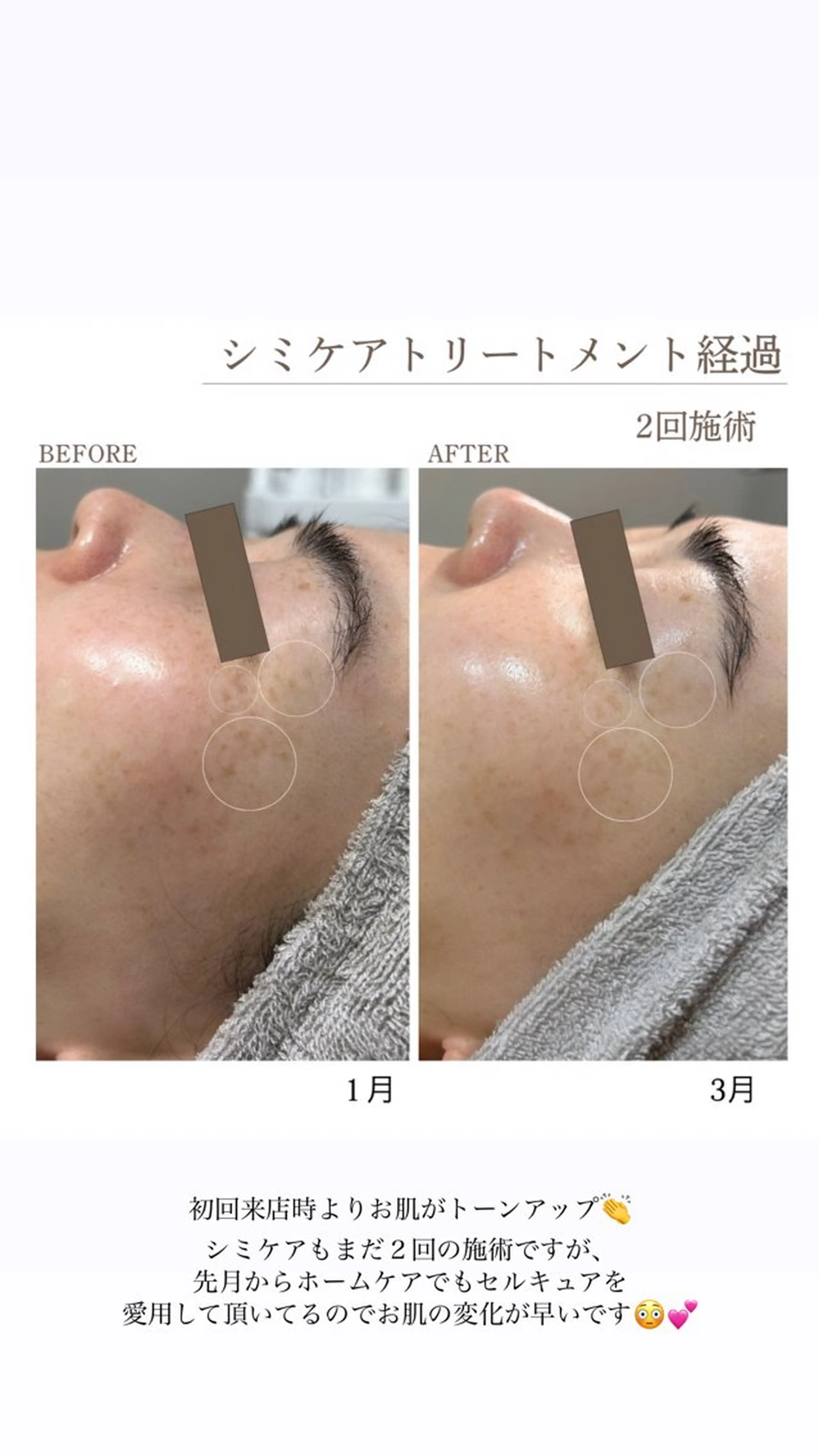 シミケア・肌育サロン Jullyのエステ・リラクイメージ