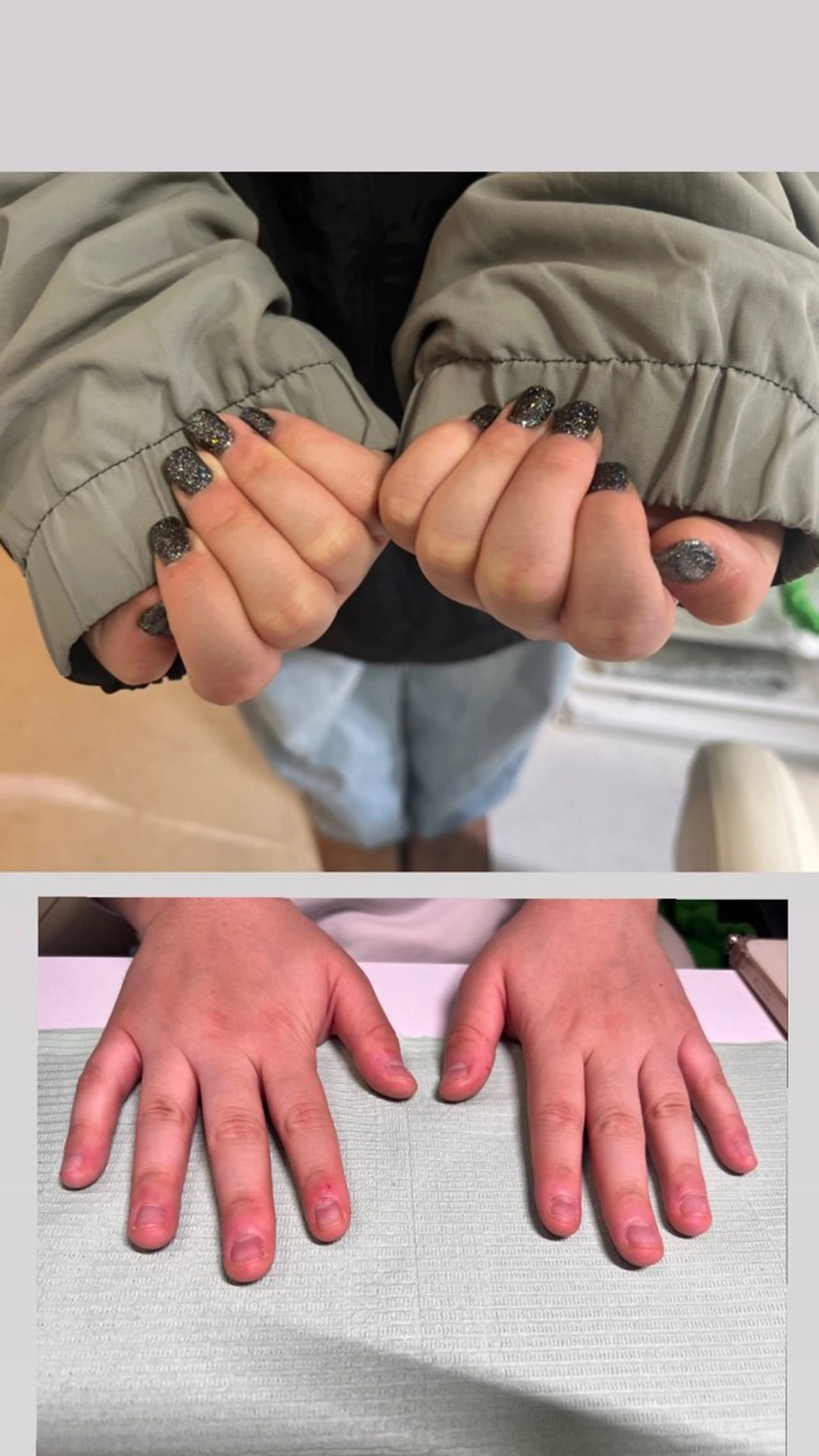 メンズ ネイル 爪ケア/深爪 自爪育成 🐰えむのネイルデザイン